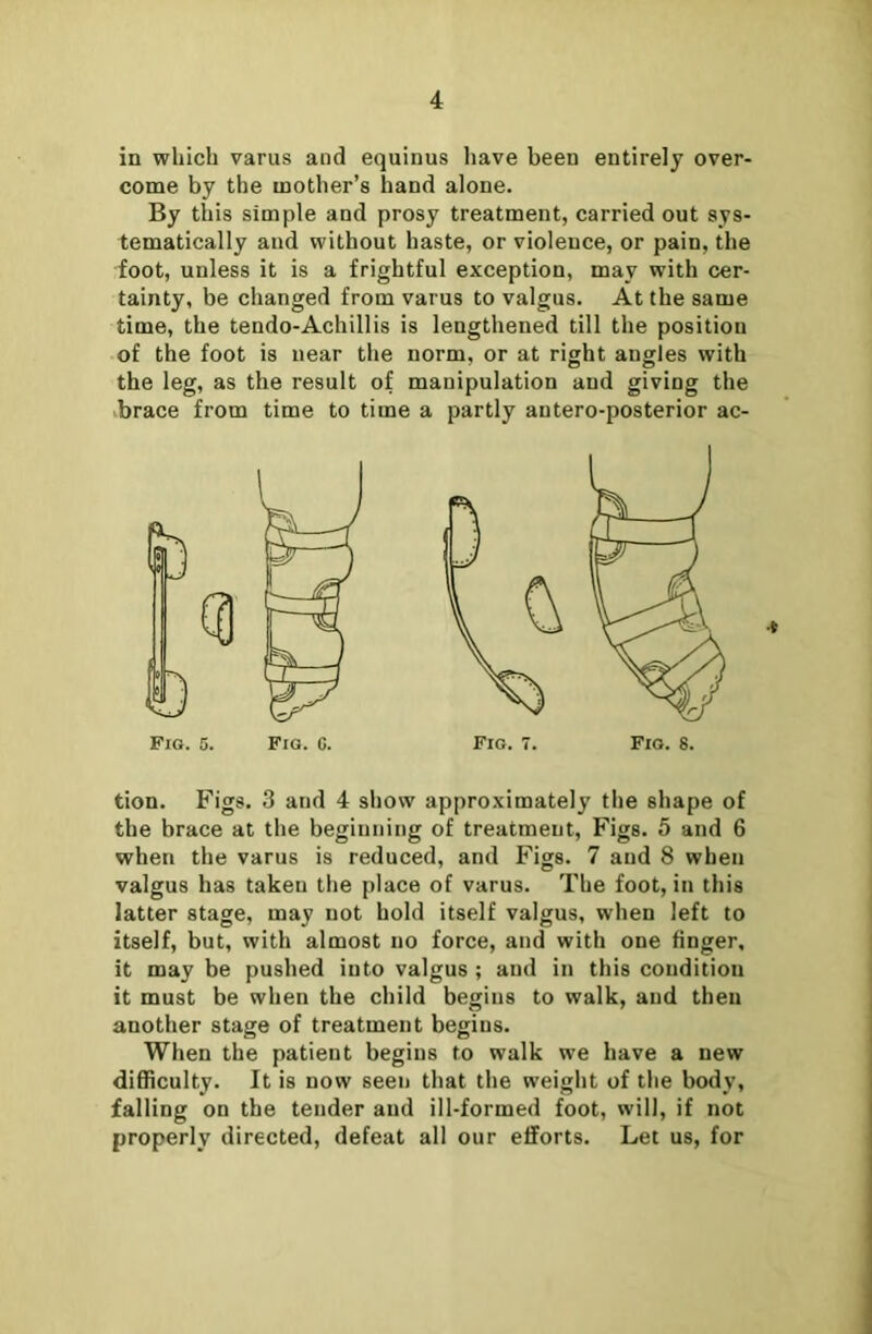 in which varus and equinus have been entirely over- come by the mother’s hand alone. By this simple and prosy treatment, carried out sys- tematically and without haste, or violence, or pain, the foot, unless it is a frightful exception, may with cer- tainty, be changed from varus to valgus. At the same time, the tendo-Achillis is lengthened till the position of the foot is near the norm, or at right angles with the leg, as the result of manipulation and giving the brace from time to time a partly antero-posterior ac- tion. F igs- 3 and 4 show approximately the shape of the hrace at the beginning of treatment, Figs. 5 and 6 when the varus is reduced, and Figs. 7 and 8 when valgus has taken the place of varus. The foot, in this latter stage, may not hold itself valgus, when left to itself, but, with almost no force, and with one finger, it may be pushed into valgus ; and in this condition it must be when the child begins to walk, and then another stage of treatment begins. When the patient begins to walk we have a new difficulty. It is now seen that the weight of the body, falling on the tender and ill-formed foot, will, if not properly directed, defeat all our efforts. Let us, for