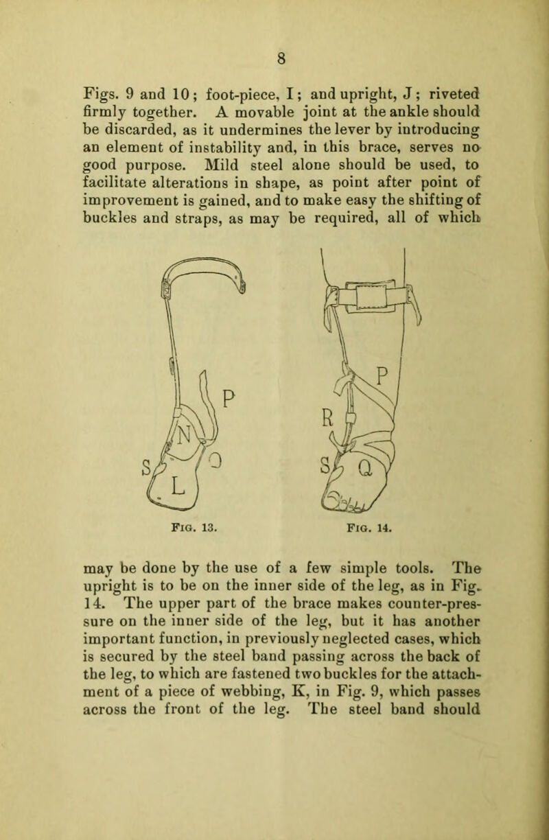 Figs. 9 and 10; foot-piece, I; and upright, J; riveted firmly together. A movable joint at the ankle should be discarded, as it undermines the lever by introducing an element of instability and, in this brace, serves no good purpose. Mild steel alone should be used, to facilitate alterations in shape, as point after point of improvement is gained, and to make easy the shifting of buckles and straps, as may be required, all of which may be done by the use of a few simple tools. The upright is to be on the inner side of the leg, as in Fig. 14. The upper part of the brace makes counter-pres- sure on the inner side of the leg, but it has another important function, in previously neglected cases, which is secured by the steel baud passing across the back of the leg, to which are fastened two buckles for the attach- ment of a piece of webbing, K, in Fig. 9, which passes across the front of the leg. The steel band should