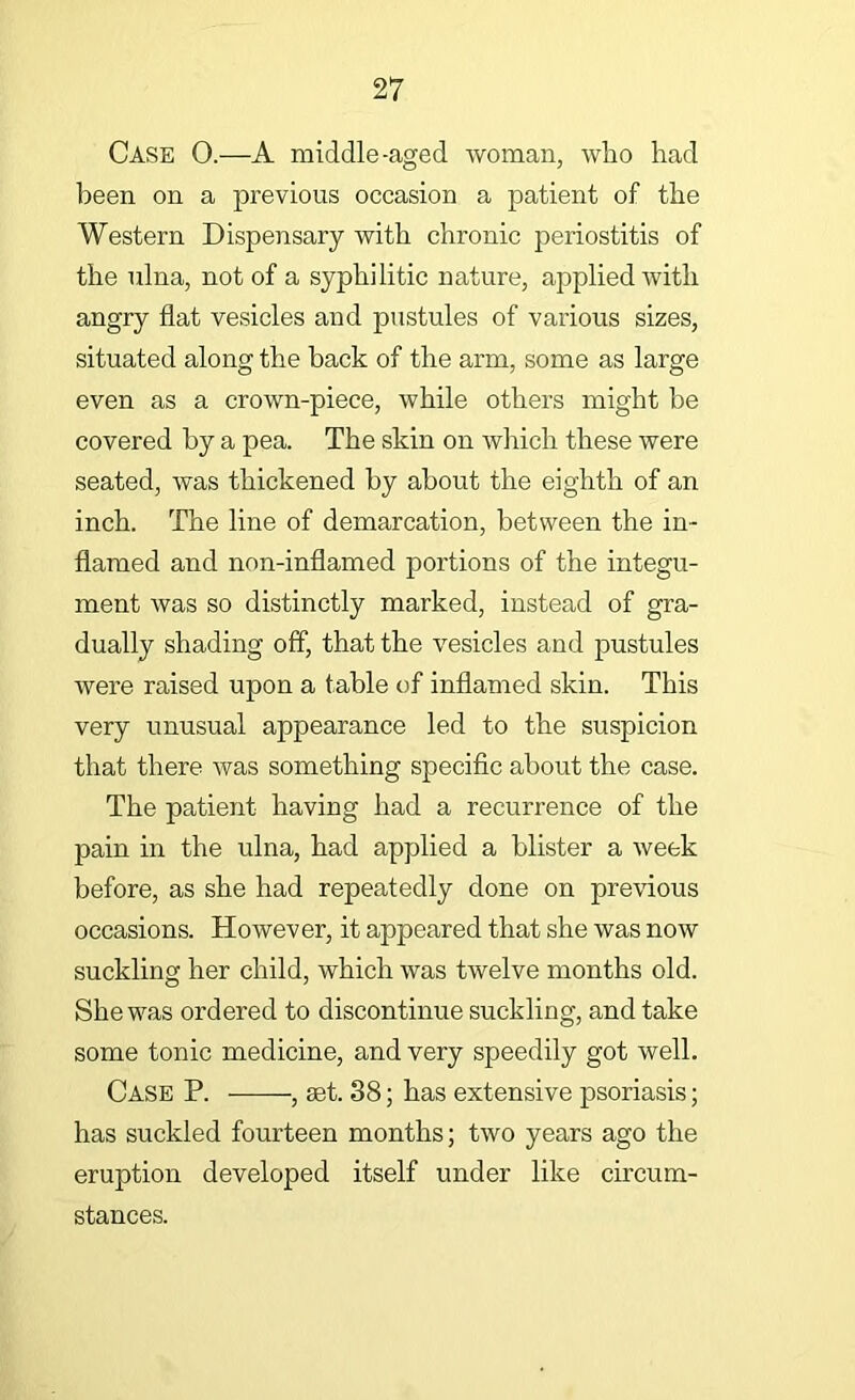 Case 0.—A middle-aged woman, who had been on a previous occasion a patient of the Western Dispensary with chronic periostitis of the ulna, not of a syphilitic nature, applied with angry flat vesicles and pustules of various sizes, situated along the back of the arm, some as large even as a crown-piece, while others might be covered by a pea. The skin on which these were seated, was thickened by about the eighth of an inch. The line of demarcation, between the in- flamed and non-inflamed portions of the integu- ment was so distinctly marked, instead of gra- dually shading off, that the v^esicles and pustules were raised upon a table of inflamed skin. This very unusual appearance led to the suspicion that there was something specific about the case. The patient having had a recurrence of the pain in the ulna, had applied a blister a week before, as she had repeatedly done on previous occasions. However, it appeared that she was now suckling her child, which was twelve months old. She was ordered to discontinue suckling, and take some tonic medicine, and very speedily got well. Case P. , aet. 38; has extensive psoriasis; has suckled fourteen months; two years ago the eruption developed itself under like circum- stances.