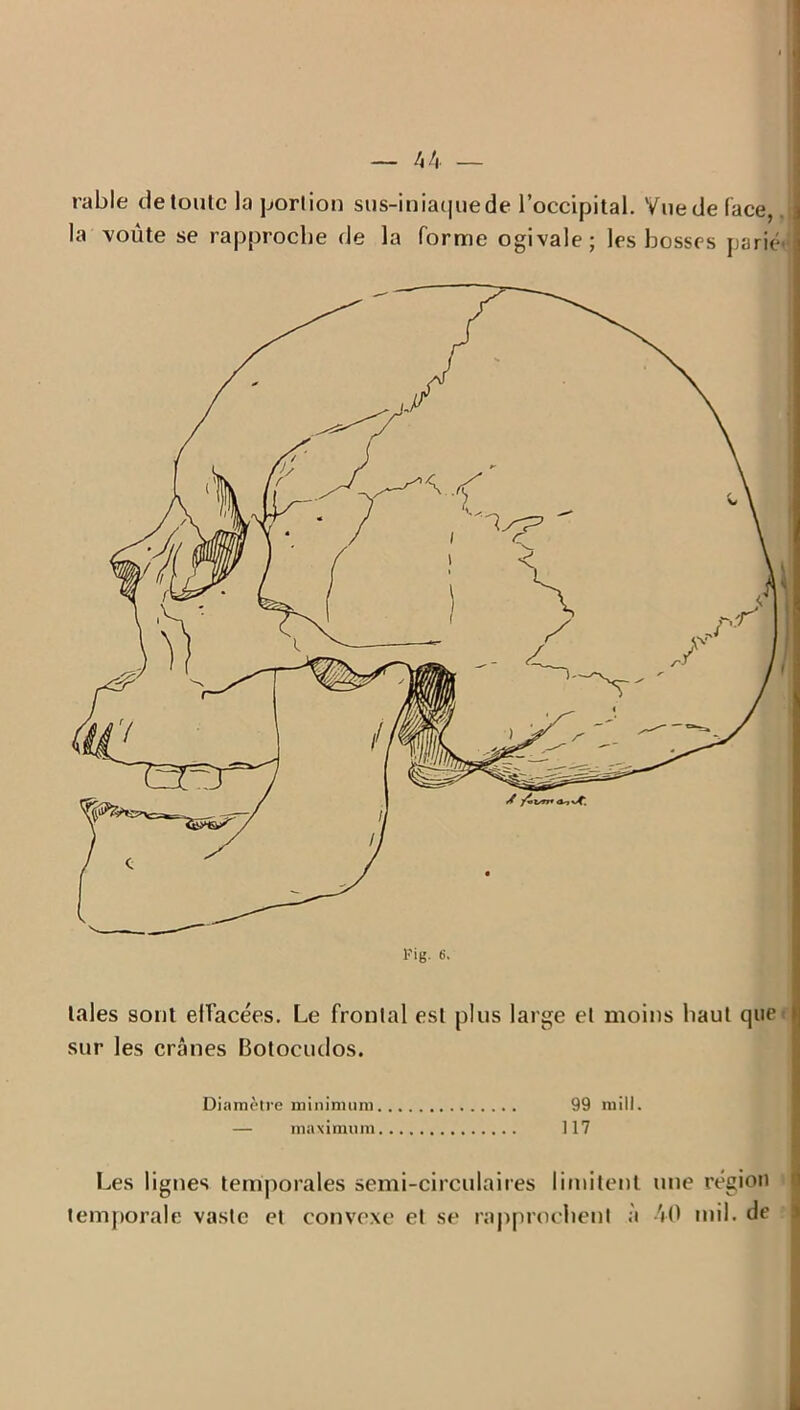 rable de toute la portion sus-iniaquede l’occipital. Vue de face, la voûte se rapproche de la forme ogivale; les bosses parié taies sont effacées. Le frontal est plus large et moins haut que sur les crânes Botocudos. Diamètre minimum 99 mill. — maximum 117 Les lignes temporales semi-circulaires limitent une région temporale vaste et convexe et se rapprochent à 40 mil. de