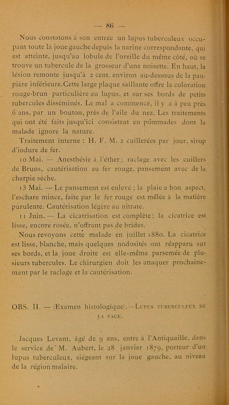 — 8(i Nous constatons à son entrée un lupus tuberculeux occu- pant toute la joue gauche depuis la narine correspondante, qui est atteinte, jusqu’au lobule de l’oreille du meme côté, où se trouve un tubercule de la grosseur d’une noisette. En haut, la lésion remonte jusqu’à 2 cent, environ au-dessous de la pau- pière inférieure.Cette large plaque saillante offre la coloration rouge-brun particulière au lupus, et sur ses bords de petits tubercules disséminés. Le mal a commencé, il y a à peu près .6 ans, par un bouton, près de l’aile du nez. Les traitements qui ont été faits jusqu’ici consistent en pommades dont la malade ignore la nature. Traitement interne : H. F. M. 2 cuillerées par jour, sirop d’iodure de fer. 10 Mai. — Anesthésie à l’éther; raclage avec les cuillers de Bruns, cautérisation au fer rouge, pansement avec de la charpie sèche. i3 Mai. — Le pansement est enlevé ; la plaie a bon aspect, l’eschare mince, faite par le fer rouge est mêlée à la matière purulente. Cautérisation légère au nitrate. 11 Juin. — La cicatrisation est complète ; la cicatrice est lisse, encore rosée, n’offrant pas de brides. Nous revoyons cette malade en juillet 1880. La cicatrice est lisse, blanche, mais quelques nodosités ont réapparu sur ses bords, et la joue droite est elle-même parsemée de plu- sieurs tubercules. Le chirurgien doit les attaquer prochaine- ment par le raclage et la cautérisation. OBS. IL — (Examen histologique'.—Lupus tubercuueux du r. v FACE. Jacques Levant, âgé de 9 ans, entre à l’Antiquaille, dans le service de'M. Aubert, le 28 janvier 1879. porteur d’un lupus tuberculeux, siégeant sur la joue gauche, au niveau delà région malaire.