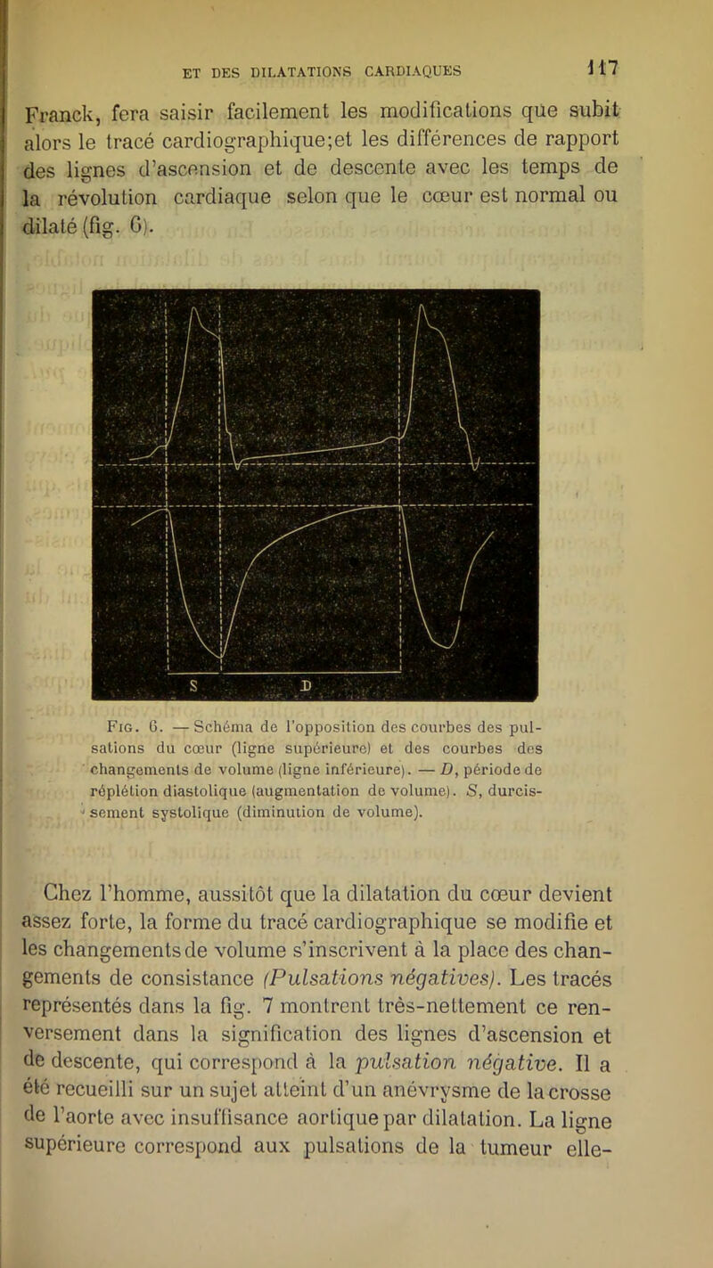 Franck, fera saisir facilement les modifications que subit alors le tracé cardiographique;et les différences de rapport des lignes d’ascension et de descente avec les temps de la révolution cardiaque selon que le cœur est normal ou dilaté (fig. G). Fig. 6. —schéma de l'opposition des courbes des pul- sations du cœur (ligne supérieure) et des courbes des changements de volume (ligne inférieure). — D, période de réplétion diastolique (augmentation de volume). S, durcis- sement systolique (diminution de volume). Chez l’homme, aussitôt que la dilatation du cœur devient assez forte, la forme du tracé cardiographique se modifie et les changements de volume s’inscrivent à la place des chan- gements de consistance (Pulsations négatives). Les tracés représentés dans la fig. 7 montrent très-nettement ce ren- versement dans la signification des lignes d’ascension et de descente, qui correspond à la pulsation négative. Il a été recueilli sur un sujet atteint d’un anévrysme de la crosse de l’aorte avec insuffisance aortique par dilatation. La liune supérieure correspond aux pulsations de la tumeur elle-