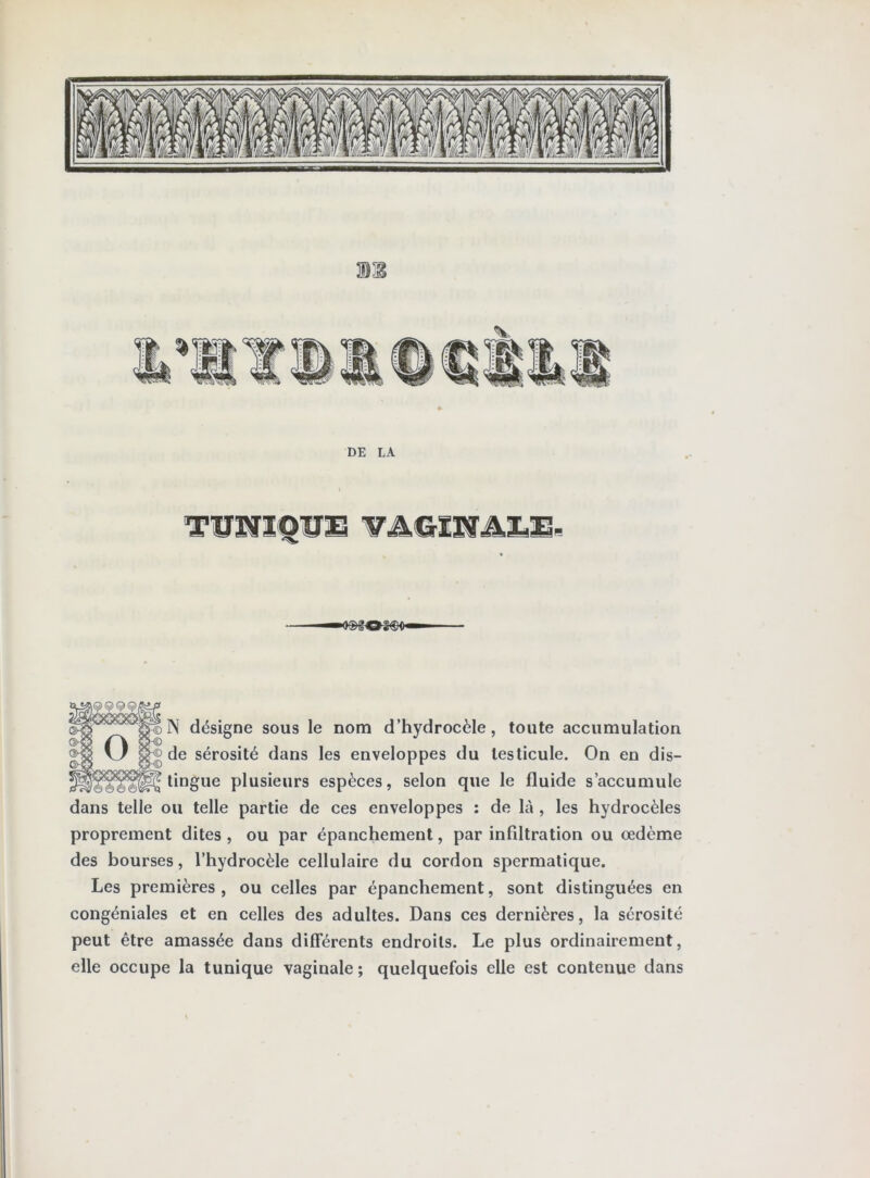 DE LA N désigne sous le nom d’hydrocèle, toute accumulation de sérosité dans les enveloppes du testicule. On en dis- tingue plusieurs espèces, selon que le fluide s’accumule dans telle ou telle partie de ces enveloppes : de là , les hydrocèles proprement dites, ou par épanchement, par infiltration ou œdème des bourses, l’hydrocèle cellulaire du cordon spermatique. Les premières , ou celles par épanchement, sont distinguées en congéniales et en celles des adultes. Dans ces dernières, la sérosité peut être amassée dans différents endroits. Le plus ordinairement, elle occupe la tunique vaginale ; quelquefois elle est contenue dans