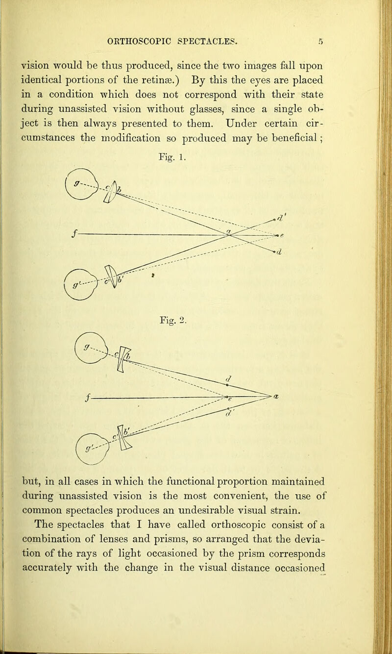 vision would be thus produced, since the two images fall upon identical portions of the retinae.) By this the eyes are placed in a condition which does not correspond with their state during unassisted vision without glasses, since a single ob- ject is then always presented to them. Under certain cir- cumstances the modification so produced may be beneficial; Fig. 1. Fig. 2. but, in all cases in which the functional proportion maintained during unassisted vision is the most convenient, the use of common spectacles produces an undesirable visual strain. The spectacles that I have called orthoscopic consist of a combination of lenses and prisms, so arranged that the devia- tion of the rays of light occasioned by the prism corresponds accurately with the change in the visual distance occasioned