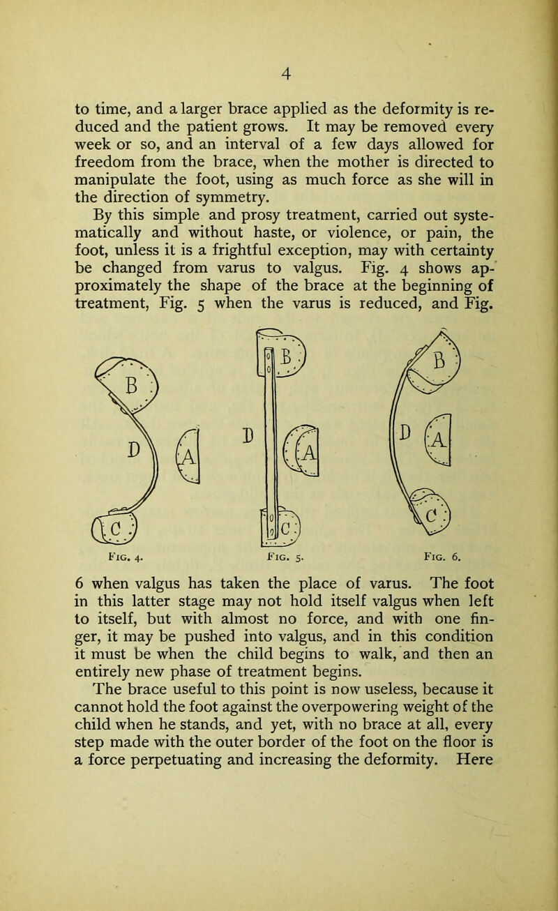 to time, and a larger brace applied as the deformity is re- duced and the patient grows. It may be removed every week or so, and an interval of a few days allowed for freedom from the brace, when the mother is directed to manipulate the foot, using as much force as she will in the direction of symmetry. By this simple and prosy treatment, carried out syste- matically and without haste, or violence, or pain, the foot, unless it is a frightful exception, may with certainty be changed from varus to valgus. Fig. 4 shows ap- proximately the shape of the brace at the beginning of treatment, Fig. 5 when the varus is reduced, and Fig. 6 when valgus has taken the place of varus. The foot in this latter stage may not hold itself valgus when left to itself, but with almost no force, and with one fin- ger, it may be pushed into valgus, and in this condition it must be when the child begins to walk, and then an entirely new phase of treatment begins. The brace useful to this point is now useless, because it cannot hold the foot against the overpowering weight of the child when he stands, and yet, with no brace at all, every step made with the outer border of the foot on the floor is a force perpetuating and increasing the deformity. Here Fig. 4. Fig. 5. Fig. 6.