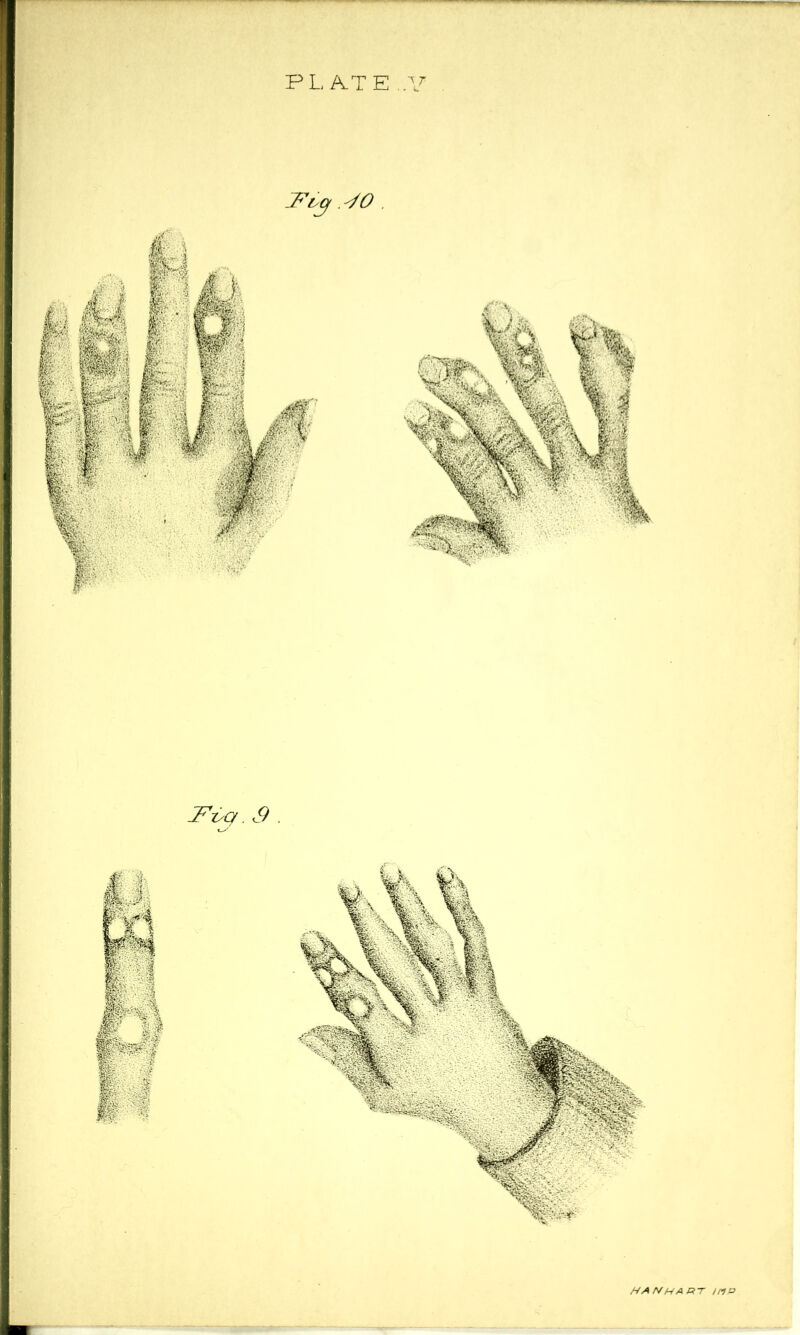 PL/VTE ,V Fxyq. 3 HAN HART mR