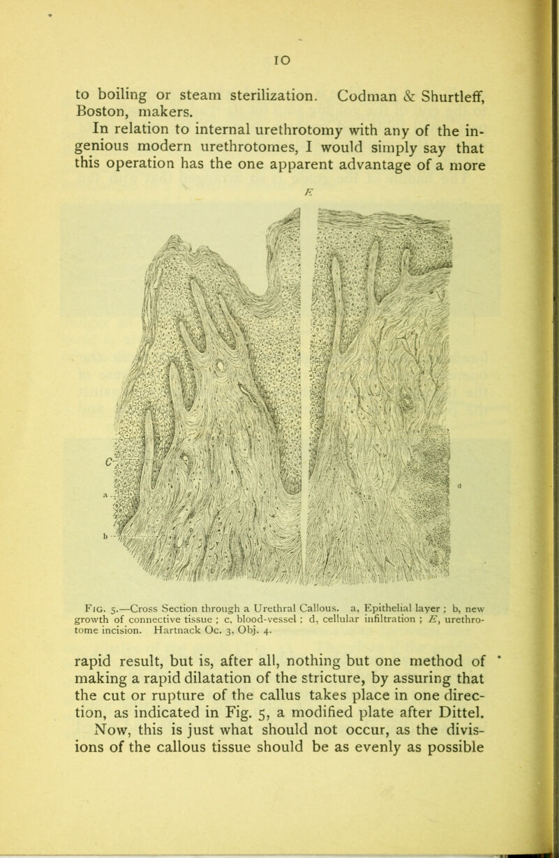 lO to boiling or steam sterilization. Codman & ShurtlefF, Boston, makers. In relation to internal urethrotomy with any of the in- genious modern urethrotomes, I would simply say that this operation has the one apparent advantage of a more Fjg. 5.—Cross Section through a Urethral Callous, a, Epithelial layer ; b, new growth of connective tissue ; c, blood-vessel ; d, cellular infiltration ; urethro- tome incision. Hartnack Oc. 3, Obj. 4. rapid result, but is, after all, nothing but one method of making a rapid dilatation of the stricture, by assuring that the cut or rupture of the callus takes place in one direc- tion, as indicated in Fig. 5, a modified plate after Dittel. Now, this is just what should not occur, as the divis- ions of the callous tissue should be as evenly as possible