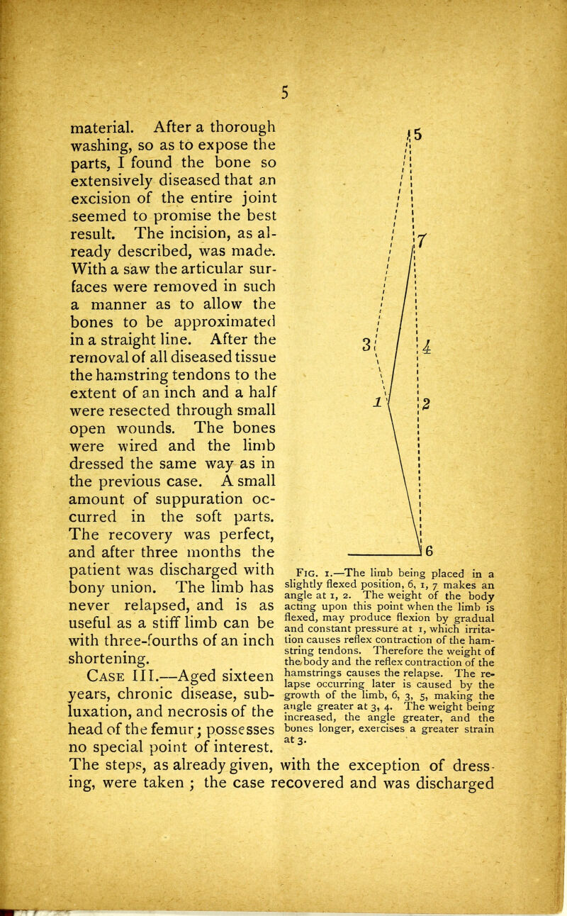 material. After a thorough washing, so as to expose the parts, I found the bone so extensively diseased that an excision of the entire joint seemed to promise the best result. The incision, as al- ready described, was made*. With a saw the articular sur- faces were removed in such a manner as to allow the bones to be approximated in a straight line. After the removal of all diseased tissue the hamstring tendons to the extent of an inch and a half were resected through small open wounds. The bones were wired and the limb dressed the same way as in the previous case. A small amount of suppuration oc- curred in the soft parts. The recovery was perfect, and after three months the patient was discharged with bony union. The limb has never relapsed, and is as useful as a stiff limb can be with three-fourths of an inch shortening. Case III.—Aged sixteen years, chronic disease, sub- luxation, and necrosis of the *5 Fig. i.—The limb being placed in a slightly flexed position, 6, i, 7 makes an angle at 1, 2. The weight of the body acting upon this point when the limb is flexed, may produce flexion by gradual and constant pressure at 1, which irrita- tion causes reflex contraction of the ham- string tendons. Therefore the weight of the/body and the reflex contraction of the hamstrings causes the relapse. The re- lapse occurring later is caused by the growth of the limb, 6, 3, 5, making the angle greater at 3, 4. The weight being increased, the angle greater, and the head of the femur; possesses b°nes longer, exercises a greater strain no special point of interest. a 3' The steps, as already given, with the exception of dress- ing, were taken ; the case recovered and was discharged