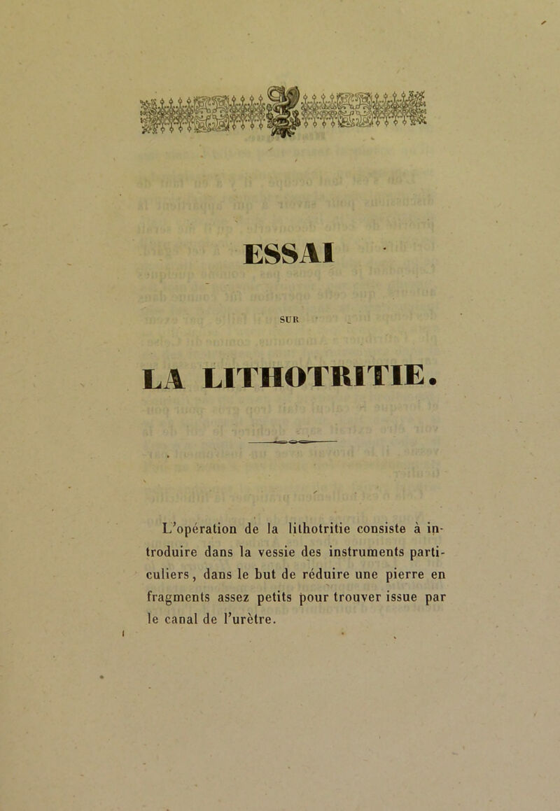 SU U LA LITHOTRITIE. L’opération de la lithotritie consiste à in- troduire dans la vessie des instruments parti- culiers, dans le but de réduire une pierre en N . fragments assez petits pour trouver issue par le canal de l’urètre. i