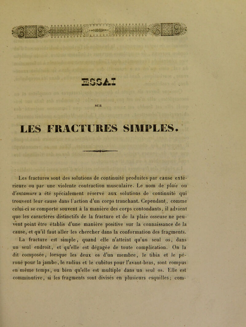 SUR LES FRACTURES SIMPLES. Les fractures sont des solutions de continuité produites'par cause exté- rieure ou par une violente contraction musculaire. Le nom Ae plaie ou A’entamure a été spécialement réservé aux solutions de continuité qui trouvent leur cause dans l’action d’un corps tranchant. Cependant, comme celui-ci se comporte souvent à la manière des corps contondants, il advient que les caractères distinctifs de la fracture et de la plaie osseuse ne peu- vent point être établis d’une manière positive sur la connaissance de la cause, et qu’il faut aller les chercher dans la conformation des fragments. La fracture est simple, quand elle n’atteint qu’un seul os, dans un seul endroit, et qu’elle est dégagée de toute complication. On la dit composée, lorsque les deux os d’un membre, le tibia et le pé- roné pour la jambe, le radius et le cubitus pour l’avant-bras, sont rompus en même temps, ou bien qu’elle est multiple dans un seul os. Elle est comminutive, si les fragments sont divisés en plusieurs esquilles; com-