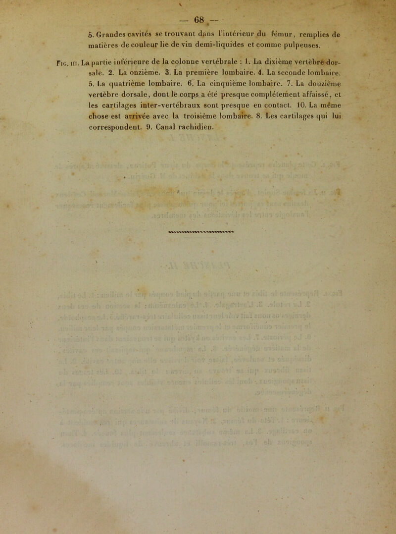 c 6. Graudes cavités se trouvant dans l’intérieur du fémur, remplies de matières de couleur lie de vin demi-liquides et comme pulpeuses. Fie. ni. La partie inférieure de la colonne vertébrale : 1. La dixième vertèbre dor- sale. 2. La onzième. 3. La première lombaire. 4. La seconde lombaire. 5. La quatrième lombaire. 6. La cinquième lombaire. 7. La douzième vertèbre dorsale, dont le corps a été presque complètement affaissé, et les cartilages inter-vertébraux sont presque en contact. 10. La même chose est arrivée avec la troisième lombaire. 8. Les cartilages qui lui correspondent. 9. Canal rachidien.