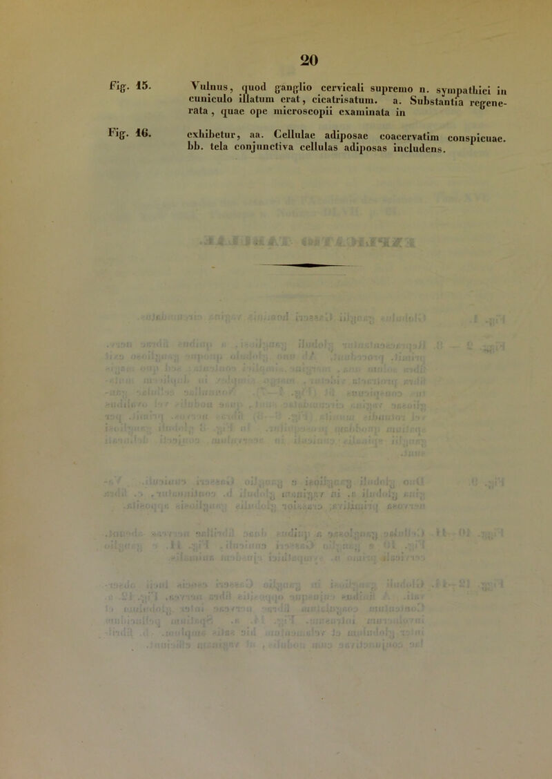 Fjg. 15. Vulnus, quod ganglio cervicali supremo n. sympathici in cuniculo illatum erat, cicatrisatuiu. a. Substantia regene- rata , quae ope microscopii examinata in Fig. 16. exhibetur, aa. Cellulae adiposae coaecrvatim conspicuae, hh. tela conjunctiva cellulas adiposas includens. 1 IcOJ 5 'Tt U Ijltli i