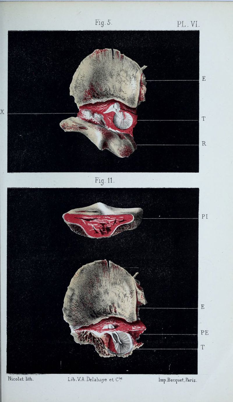 PL. VI. Fig. 5. Fig.11. ÎLicolet litti. Lib.VA.Delahaye et Cie Imp.Beccpet.Paris.