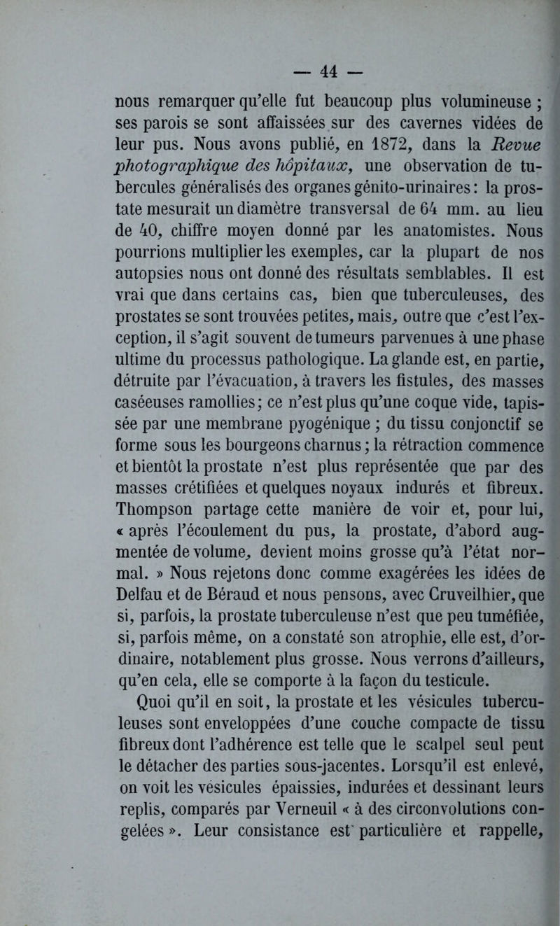 nous remarquer qu’elle fut beaucoup plus volumineuse ; ses parois se sont affaissées sur des cavernes vidées de leur pus. Nous avons publié, en 1872, dans la Revue photographique des hôpitaux, une observation de tu- bercules généralisés des organes génito-urinaires : la pros- tate mesurait un diamètre transversal de 64 mm. au lieu de 40, chiffre moyen donné par les anatomistes. Nous pourrions multiplier les exemples, car la plupart de nos autopsies nous ont donné des résultats semblables. Il est vrai que dans certains cas, bien que tuberculeuses, des prostates se sont trouvées petites, mais, outre que c’est l’ex- ception, il s’agit souvent de tumeurs parvenues à une phase ultime du processus pathologique. La glande est, en partie, détruite par l’évacuation, à travers les fistules, des masses caséeuses ramollies; ce n’est plus qu’une coque vide, tapis- sée par une membrane pyogénique ; du tissu conjonctif se forme sous les bourgeons charnus ; la rétraction commence et bientôt la prostate n’est plus représentée que par des masses crétifiées et quelques noyaux indurés et fibreux. Thompson partage cette manière de voir et, pour lui, « après l’écoulement du pus, la prostate, d’abord aug- mentée de volume, devient moins grosse qu’à l’état nor- mal. » Nous rejetons donc comme exagérées les idées de Delfau et de Béraud et nous pensons, avec Gruveilhier, que si, parfois, la prostate tuberculeuse n’est que peu tuméfiée, si, parfois même, on a constaté son atrophie, elle est, d’or- dinaire, notablement plus grosse. Nous verrons d’ailleurs, qu’en cela, elle se comporte à la façon du testicule. Quoi qu’il en soit, la prostate et les vésicules tubercu- leuses sont enveloppées d’une couche compacte de tissu fibreux dont l’adhérence est telle que le scalpel seul peut le détacher des parties sous-jacentes. Lorsqu’il est enlevé, on voit les vésicules épaissies, indurées et dessinant leurs replis, comparés par Yerneuil « à des circonvolutions con- gelées ». Leur consistance est' particulière et rappelle,