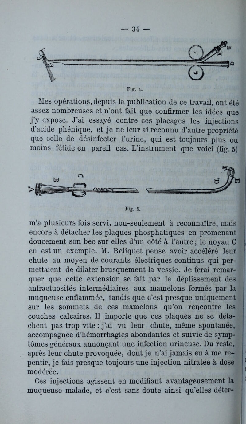 Mes opérations, depuis la publication de ce travail, ont été assez nombreuses et n’ont fait que confirmer les idées que j’y expose. J’ai essayé contre ces placages les injections d’acide phénique, et je ne leur ai reconnu d’autre propriété que celle de désinfecter l’urine, qui est toujours plus ou moins fétide en pareil cas. L’instrument que voici (fig. 5) Fig. 5. m’a plusieurs fois servi, non-seulement à reconnaître, mais encore à détacher les plaques phosphatiques en promenant doucement son bec sur elles d’un côté à l’autre ; le noyau G en est un exemple. M. Reliquet pense avoir accéléré leur chute au moyen de courants électriques continus qui per- mettaient de dilater brusquement la vessie. Je ferai remar- quer que cette extension se fait par le déplissement des anfractuosités intermédiaires aux mamelons formés par la muqueuse enflammée, tandis que c’est presque uniquement I sur les sommets de ces mamelons qu’on rencontre les couches calcaires. Il importe que ces plaques ne se déta- chent pas trop vite : j’ai vu leur chute, même spontanée, accompagnée d’hémorrhagies abondantes et suivie de symp- tômes généraux annonçant une infection urineuse. Du reste, après leur chute provoquée, dont je n’ai jamais eu à me re- pentir, je fais presque toujours une injection nitratée à dose 1 modérée. J 1 Ces injections agissent en modifiant avantageusement la ( muqueuse malade, et c’est sans doute ainsi qu’elles déter-