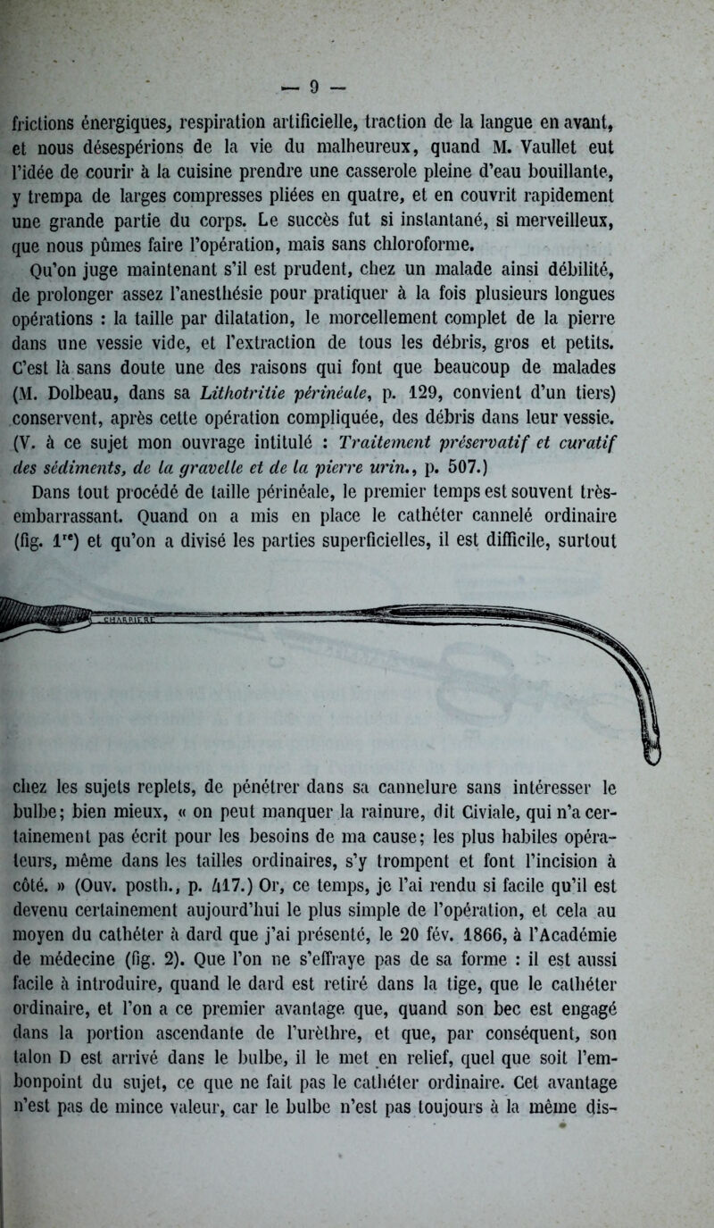 frictions énergiques, respiration artificielle, traction de la langue en avant, et nous désespérions de la vie du malheureux, quand M. Vaullet eut l’idée de courir à la cuisine prendre une casserole pleine d’eau bouillante, y trempa de larges compresses pliées en quatre, et en couvrit rapidement une grande partie du corps. Le succès fut si instantané, si merveilleux, que nous pûmes faire l’opération, mais sans chloroforme. Qu’on juge maintenant s’il est prudent, chez un malade ainsi débilité, de prolonger assez l’anesthésie pour pratiquer à la fois plusieurs longues opérations : la taille par dilatation, le morcellement complet de la pierre dans une vessie vide, et l’extraction de tous les débris, gros et petits. C’est là sans doute une des raisons qui font que beaucoup de malades (M. Dolbeau, dans sa Lithotritie 'périnéale, p. 129, convient d’un tiers) conservent, après cette opération compliquée, des débris dans leur vessie. (V. à ce sujet mon ouvrage intitulé : Traitement préservatif et curatif des sédiments, de la gravelle et de la pierre urin., p. 507.) Dans tout procédé de taille périnéale, le premier temps est souvent très- embarrassant. Quand on a mis en place le cathéter cannelé ordinaire (fig. lre) et qu’on a divisé les parties superficielles, il est difficile, surtout chez les sujets replets, de pénétrer dans sa cannelure sans intéresser le bulbe; bien mieux, « on peut manquer la rainure, dit Civiale, qui n’a cer- tainement pas écrit pour les besoins de ma cause; les plus habiles opéra- teurs, même dans les tailles ordinaires, s’y trompent et font l’incision à côté. » (Ouv. posth., p. Ml.) Or, ce temps, je l’ai rendu si facile qu’il est devenu certainement aujourd’hui le plus simple de l’opération, et cela au moyen du cathéter à dard que j’ai présenté, le 20 fév. 1866, à l’Académie de médecine (fig. 2). Que l’on ne s’effraye pas de sa forme : il est aussi facile à introduire, quand le dard est retiré dans la tige, que le cathéter ordinaire, et l’on a ce premier avantage que, quand son bec est engagé clans la portion ascendante de l’urèthre, et que, par conséquent, son talon D est arrivé dans le bulbe, il le met en relief, quel que soit l’em- bonpoint du sujet, ce que ne fait pas le cathéter ordinaire. Cet avantage n’est pas de mince valeur, car le bulbe n’est pas toujours à la même dis-