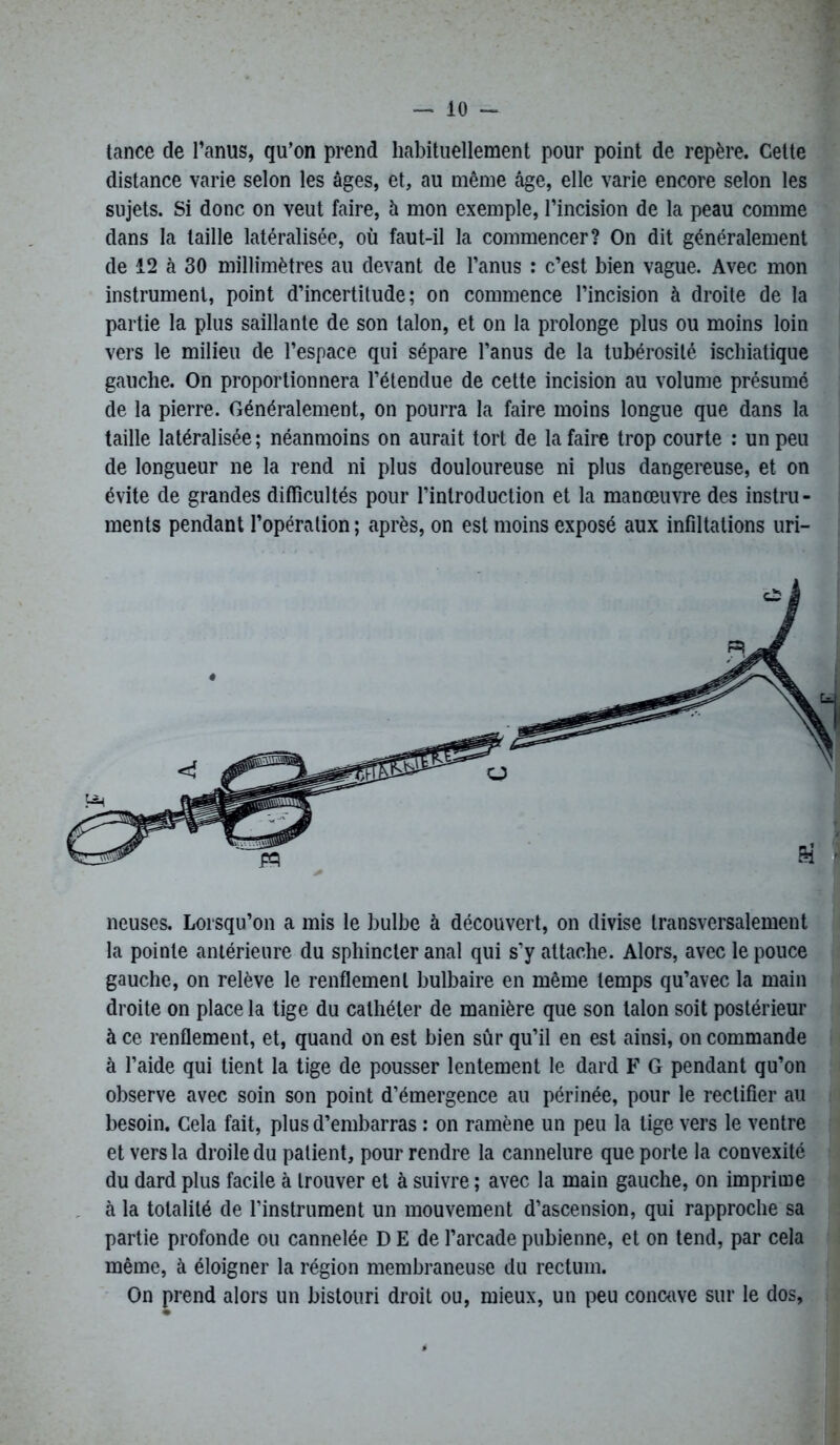 tance de l’anus, qu’on prend habituellement pour point de repère. Cette distance varie selon les âges, et, au même âge, elle varie encore selon les sujets. Si donc on veut faire, à mon exemple, l’incision de la peau comme dans la taille latéralisée, où faut-il la commencer? On dit généralement de 12 à 30 millimètres au devant de l’anus : c’est bien vague. Avec mon instrument, point d’incertitude; on commence l’incision à droite de la partie la plus saillante de son talon, et on la prolonge plus ou moins loin vers le milieu de l’espace qui sépare l’anus de la tubérosité ischiatique gauche. On proportionnera l’étendue de cette incision au volume présumé de la pierre. Généralement, on pourra la faire moins longue que dans la taille latéralisée; néanmoins on aurait tort de la faire trop courte : un peu de longueur ne la rend ni plus douloureuse ni plus dangereuse, et on évite de grandes difficultés pour l’introduction et la manœuvre des instru- ments pendant l’opération ; après, on est moins exposé aux infîltations uri- neuses. Lorsqu’on a mis le bulbe à découvert, on divise transversalement la pointe antérieure du sphincter anal qui s’y attache. Alors, avec le pouce gauche, on relève le renflement bulbaire en même temps qu’avec la main droite on place la tige du cathéter de manière que son talon soit postérieur à ce renflement, et, quand on est bien sûr qu’il en est ainsi, on commande à l’aide qui tient la tige de pousser lentement le dard F G pendant qu’on observe avec soin son point d’émergence au périnée, pour le rectifier au besoin. Cela fait, plus d’embarras : on ramène un peu la lige vers le ventre et vers la droile du patient, pour rendre la cannelure que porte la convexité du dard plus facile à trouver et à suivre ; avec la main gauche, on imprime à la totalité de l’instrument un mouvement d’ascension, qui rapproche sa partie profonde ou cannelée D E de l’arcade pubienne, et on tend, par cela même, à éloigner la région membraneuse du rectum. On prend alors un bistouri droit ou, mieux, un peu concave sur le dos,