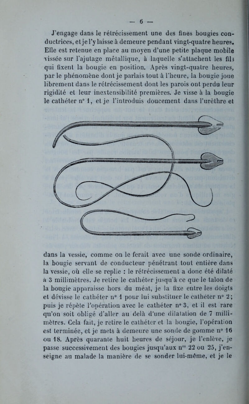 J’engage dans le rétrécissement une des fines bougies con- ductrices, et je l’y laisse à demeure pendant vingt-quatre heures. Elle est retenue en place au moyen d’une petite plaque mobile vissée sur l'ajutage métallique, à laquelle s’attachent les fils qui fixent la bougie en position. Après vingt-quatre heures, par le phénomène dont je parlais tout à l’heure, la bougie joue librement dans le rétrécissement dont les parois ont perdu leur rigidité et leur inextensibilité premières. Je visse à la bougie le cathéter n° 1, et je l’introduis doucement dans l’urèthre et dans la vessie, comme on le ferait avec une sonde ordinaire, la bougie servant de conducteur pénétrant tout entière dans la vessie, où elle se replie : le rétrécissement a donc été dilaté à 3 millimètres. Je retire le cathéter jusqu’à ce que le talon de la bougie apparaisse hors du méat, je la fixe entre les doigts et dévisse le cathéter n° 1 pour lui substituer le cathéter n° *2; puis je répète l'opération avec le cathéter n° 3, et il est rare qu’on soit obligé d’aller au delà d’une dilatation de 7 milli- mètres. Cela fait, je retire le cathéter et la bougie, l’opération est terminée, et je mets à demeure une sonde de gomme n° 16 ou 18. Après quarante huit heures de séjour, je l’enlève, je passe successivement des bougies jusqu’aux nos 22 ou 25, j’en- seigne au malade la manière de se sonder lui-même, et je le