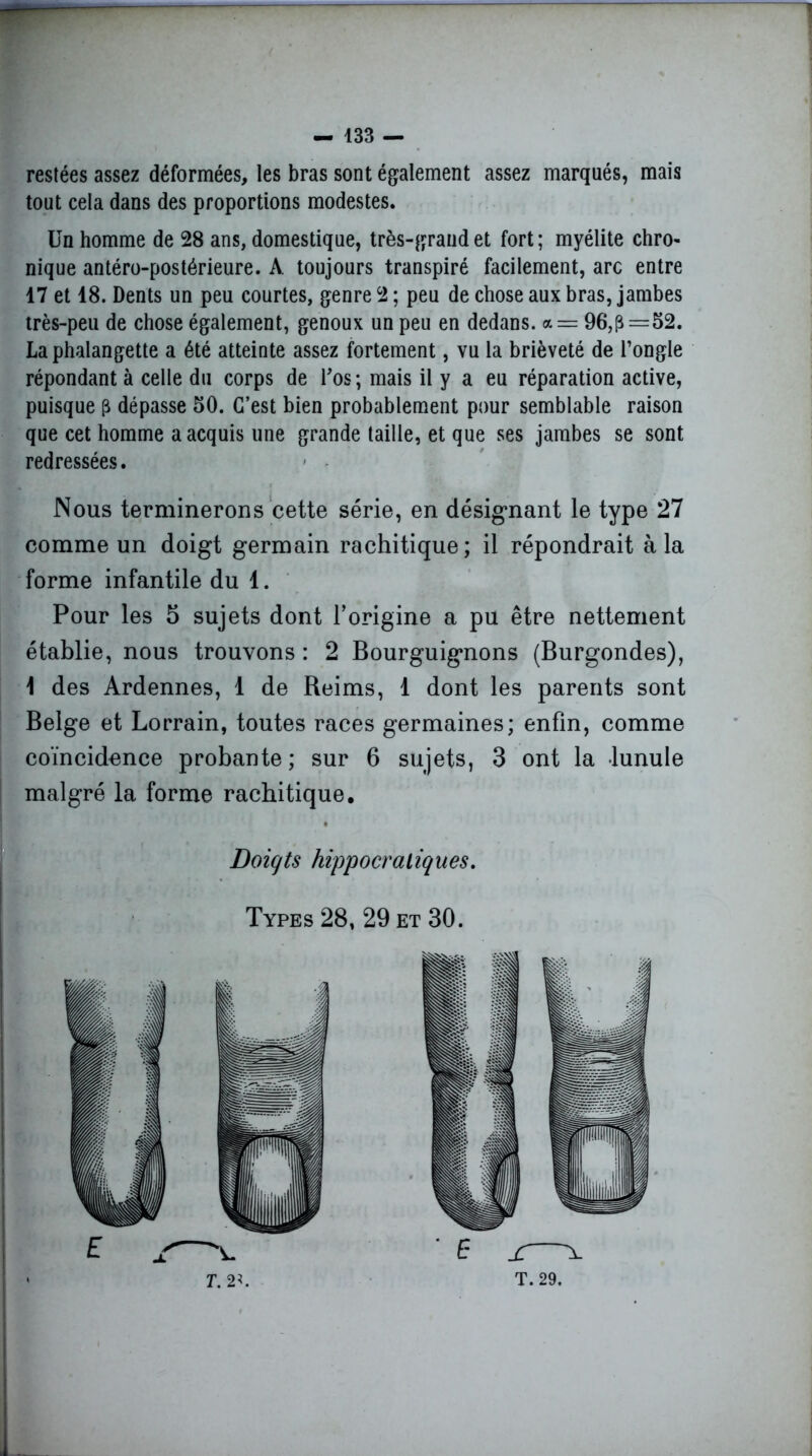 1 — 133 — restées assez déformées, les bras sont également assez marqués, mais tout cela dans des proportions modestes. Un homme de 28 ans, domestique, très-grand et fort ; myélite chro- nique antéro-postérieure. A toujours transpiré facilement, arc entre 17 et 18. Dents un peu courtes, genre 2 ; peu de chose aux bras, jambes très-peu de chose également, genoux un peu en dedans, a = 96,3=52. La phalangette a été atteinte assez fortement, vu la brièveté de l’ongle répondant à celle du corps de l'os; mais il y a eu réparation active, puisque p dépasse 50. C’est bien probablement pour semblable raison que cet homme a acquis une grande taille, et que ses jambes se sont redressées. Nous terminerons cette série, en désignant le type 27 comme un doigt germain rachitique; il répondrait à la forme infantile du 1. Pour les 5 sujets dont l’origine a pu être nettement établie, nous trouvons : 2 Bourguignons (Burgondes), \ des Ardennes, 1 de Reims, 1 dont les parents sont Belge et Lorrain, toutes races germaines; enfin, comme coïncidence probante ; sur 6 sujets, 3 ont la lunule malgré la forme rachitique. Doigts hippocratiques. Types 28, 29 et 30.