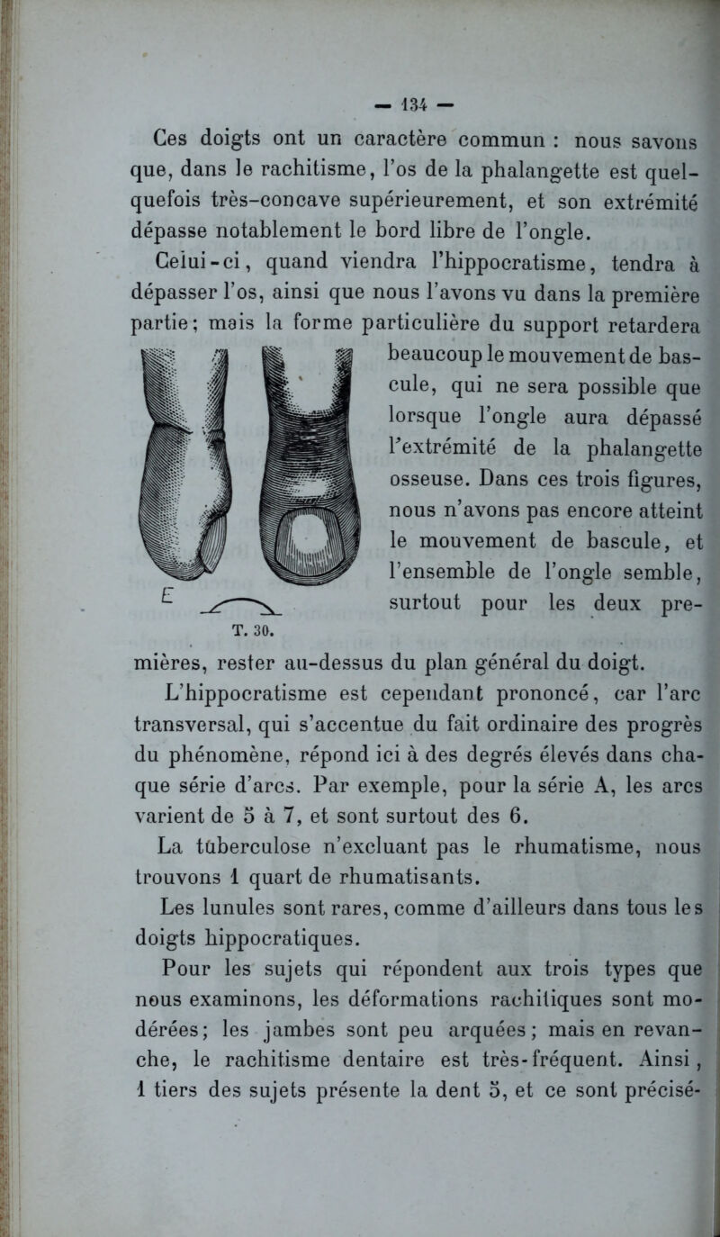 — 134 — Ces doigts ont un caractère commun : nous savons que, dans le rachitisme, l’os de la phalangette est quel- quefois très-concave supérieurement, et son extrémité dépasse notablement le bord libre de l’ongle. Celui-ci, quand viendra l’hippocratisme, tendra à dépasser l’os, ainsi que nous l’avons vu dans la première partie; mais la forme particulière du support retardera beaucoup le mouvement de bas- cule, qui ne sera possible que lorsque l’ongle aura dépassé Pextrémité de la phalangette osseuse. Dans ces trois figures, nous n’avons pas encore atteint le mouvement de bascule, et l’ensemble de l’ongle semble, surtout pour les deux pre- mières, rester au-dessus du plan général du doigt. L’hippocratisme est cependant prononcé, car l’arc transversal, qui s’accentue du fait ordinaire des progrès du phénomène, répond ici à des degrés élevés dans cha- que série d’arcs. Par exemple, pour la série A, les arcs La tuberculose n’excluant pas le rhumatisme, nous trouvons 1 quart de rhumatisants. Les lunules sont rares, comme d’ailleurs dans tous les doigts hippocratiques. Pour les sujets qui répondent aux trois types que nous examinons, les déformations rachitiques sont mo- dérées; les jambes sont peu arquées; mais en revan- che, le rachitisme dentaire est très-fréquent. Ainsi, 1 tiers des sujets présente la dent 5, et ce sont précisé- T. 30.