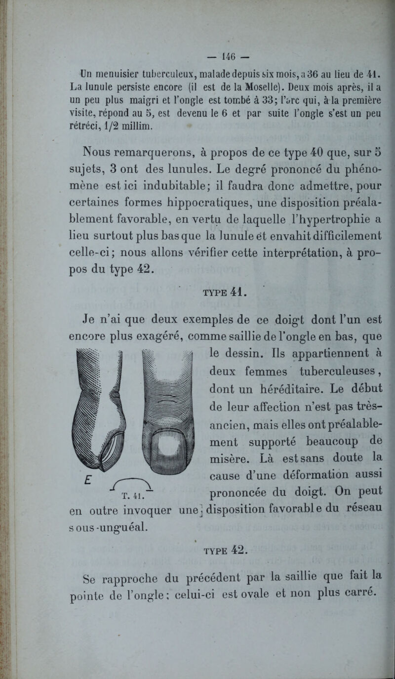 Un menuisier tuberculeux, malade depuis six mois, a 36 au lieu de 44. La lunule persiste encore (il est de la Moselle). Deux mois après, il a un peu plus maigri et l’ongle est tombé à 33; l’arc qui, à la première visite, répond au 5, est devenu le 6 et par suite l’ougle s’est un peu rétréci, 1/2 millim. Nous remarquerons, à propos de ce type 40 que, sur 5 sujets, 3 ont des lunules. Le degré prononcé du phéno- mène est ici indubitable; il faudra donc admettre, pour certaines formes hippocratiques, une disposition préala- blement favorable, en vertu de laquelle l’hypertrophie a lieu surtout plus basque la lunule et envahit difficilement celle-ci; nous allons vérifier cette interprétation, à pro- pos du type 42. TYPE 41. Je n’ai que deux exemples de ce doigt dont l’un est encore plus exagéré, comme saillie de l’ongle en bas, que le dessin. Ils appartiennent à deux femmes tuberculeuses, dont un héréditaire. Le début de leur affection n’est pas très- ancien, mais elles ont préalable- ment supporté beaucoup de misère. Là est sans doute la cause d’une déformation aussi prononcée du doigt. On peut en outre invoquer une] disposition favorable du réseau s ous-unguéal. type 42. fl Se rapproche du précédent par la saillie que fait la pointe de l’ongle; celui-ci est ovale et non plus carré.