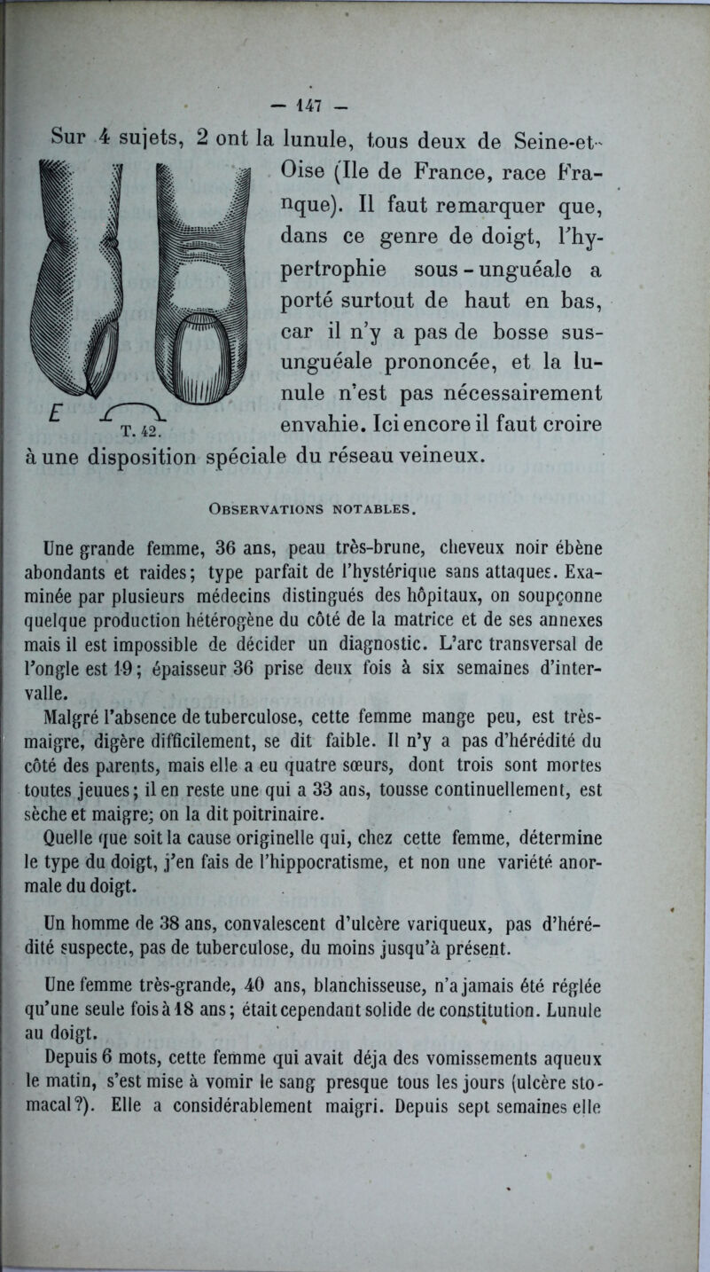 Sur 4 sujets, 2 ont la T. 42. lunule, tous deux de Seine-et- Oise (Ile de France, race Fra- nque). Il faut remarquer que, dans ce genre de doigt, l'hy- pertrophie sous - unguéale a porté surtout de haut en bas, car il n’y a pas de bosse sus- unguéale prononcée, et la lu- nule n’est pas nécessairement envahie. Ici encore il faut croire à une disposition spéciale du réseau veineux. Observations notables. Une grande femme, 36 ans, peau très-brune, cheveux noir ébène abondants et raides; type parfait de l’hystérique sans attaques. Exa- minée par plusieurs médecins distingués des hôpitaux, on soupçonne quelque production hétérogène du côté de la matrice et de ses annexes mais il est impossible de décider un diagnostic. L’arc transversal de l’ongle est 19 ; épaisseur 36 prise deux fois à six semaines d’inter- valle. Malgré l’absence de tuberculose, cette femme mange peu, est très- maigre, digère difficilement, se dit faible. Il n’y a pas d’hérédité du côté des parents, mais elle a eu quatre sœurs, dont trois sont mortes toutes jeuues; il en reste une qui a 33 ans, tousse continuellement, est sèche et maigre; on la dit poitrinaire. Quelle que soit la cause originelle qui, chez cette femme, détermine le type du doigt, j’en fais de l’hippocratisme, et non une variété anor- male du doigt. Un homme de 38 ans, convalescent d’ulcère variqueux, pas d’héré- dité suspecte, pas de tuberculose, du moins jusqu’à présent. Une femme très-grande, 40 ans, blanchisseuse, n’a jamais été réglée qu’une seule fois à 18 ans; était cependant solide de constitution. Lunule au doigt. Depuis 6 mots, cette femme qui avait déjà des vomissements aqueux le matin, s’est mise à vomir le sang presque tous les jours (ulcère sto- macal?). Elle a considérablement maigri. Depuis sept semaines elle