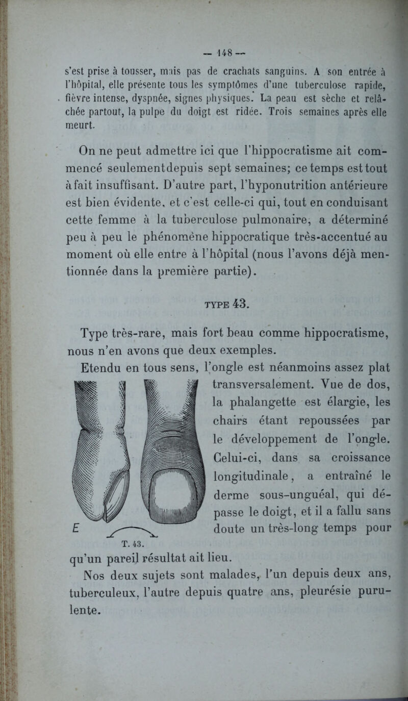 s’est prise à tousser, m:iis pas de crachats sanguins. A son entrée à l’hôpital, elle présente tous les symptômes d’une tuberculose rapide, fièvre intense, dyspnée, signes physiques. La peau est sèche et relâ- chée partout, la pulpe du doigt est ridée. Trois semaines après elle meurt. On ne peut admettre ici que l’hippocratisme ait com- mencé seulementdepuis sept semaines; ce temps est tout à fait insuffisant. D’autre part, l’hyponutrition antérieure est bien évidente, et c’est celle-ci qui, tout en conduisant cette femme à la tuberculose pulmonaire, a déterminé peu à peu le phénomène hippocratique très-accentué au moment où elle entre à l’hôpital (nous l’avons déjà men- tionnée dans la première partie). Type très-rare, mais fort beau comme hippocratisme, nous n’en avons que deux exemples. Etendu en tous sens, l’ongle est néanmoins assez plat T. 43. qu’un pareil résultat ait lieu. Nos deux sujets sont malades, l’un depuis deux ans, tuberculeux, l’autre depuis quatre ans, pleurésie puru- lente. type 43. transversalement. Vue de dos, la phalangette est élargie, les chairs étant repoussées par le développement de l’ongle. Celui-ci, dans sa croissance longitudinale, a entraîné le derme sous-unguéal, qui dé- passe le doigt, et il a fallu sans doute un très-long temps pour