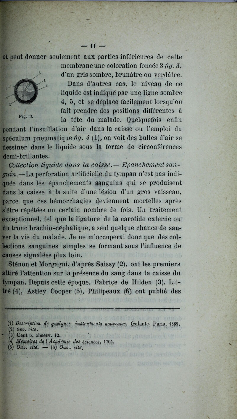 et peut donner seulement aux parties inférieures de cette pendant l’insufflation d’air dans la caisse ou l’emploi du spéculum pneumatique/^. 4 (1), on voit des bulles d’air se dessiner dans le liquide sous la forme de circonférences demi-brillantes. Collection liquide dans la caisse. — Epanchement san- guin.—La perforation artificielle du tympan n’est pas indi- quée dans les épanchements sanguins qui se produisent dans la caisse à la suite d’une lésion d’un gros vaisseau, parce que ces hémorrhagies deviennent mortelles après s’être répétées un certain nombre de fois. Un traitement exceptionnel, tel que la ligature de la carotide externe ou du tronc brachio-céphalique, a seul quelque chance de sau- ver la vie du malade. Je ne m’occuperai donc que des col- lections sanguines simples se formant sous l’influence de causes signalées plus loin. Sténon et Morgagni, d’après Saissy (2), ont les premiers attiré Pattention sur la présence du sang dans la caisse du tympan. Depuis cette époque, Fabrice de Hilden (3), Lit- tré (4), Astley Cooper (5), Philipeaux (6) ont publié des (1) Description de quelques instruments nouveaux. Grêlante, Paris, 1869. (2) Ouv. cité.  (3) Cent 5, observ. 12. . (4) Mémoires de l'Académie des sciences, 1705. (5) Ouv. cité. — (6) Ouv. cité. membrane une coloration foncée 3 fig. 5, d'un gris sombre, brunâtre ou verdâtre. Fig. 3. Dans d’autres cas, le niveau de ce liquide est indiqué par une ligne sombre 4, 5, et se déplace facilement lorsqu’on fait prendre des positions différentes à la tête du malade. Quelquefois enfin