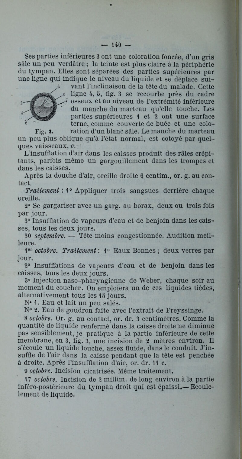 Ses parties inférieures 3 ont une coloration foncée, d’un gris sale un peu verdâtre ; la teinte est plus claire à la périphérie du tympan. Elles sont séparées des parties supérieures par une ligne qui indique le niveau du liquide et se déplace sui- vant rinclinaison de la tête du malade. Cette ligne 4, 5, fig. 3 se recourbe près du cadre osseux et au niveau de l’extrémité inférieure du manche du marteau qu’elle touche. Les parties supérieures 1 et 2 ont une surface terne, comme couverte de huée et une colo- ration d’un blanc sâle. Le manche du marteau un peu plus oblique qu’à l’état normal, est cotoyé par quel- ques vaisseaux, c. L’insufflation d’air dans les caisses produit des râles crépi- tants, parfois même un gargouillement dans les trompes et dans les caisses. Après la douche d’air, oreille droite 6 centim., or. g. au con- tact. Traitement : 1° Appliquer trois sangsues derrière chaque oreille. 2 Se gargariser avec un garg. au borax, deux ou trois fois par jour. 3° Insufflation de vapeurs d’eau et de benjoin dans les cais- ses, tous les deux jours. 30 septembre. — Tète moins congestionnée. Audition meil- leure. 1er octobre. Traitement : 1° Eaux Bonnes ; deux verres par jour. 2° Insufffations de vapeurs d’eau et de benjoin dans les caisses, tous les deux jours. 3° Injection naso-pharyngienne de Weber, chaque soir au moment du coucher. On emploiera un de ces liquides tièdes, alternativement tous les 15 jours. N* 1. Eau et lait un peu salés. N° 2. Eau de goudron faite avec l’extrait de Freyssinge. 8 octobre. Or. g. au contact, or. dr. 3 centimètres. Gomme la quantité de liquide renfermé dans la caisse droite ne diminue pas sensiblement, je pratique à la partie inférieure de cette membrane, en 3, fig. 3, une incision de 2 mètres environ. Il s’écoule un liquide louche, assez fluide, dans le conduit. J’in- suffle de l’air dans la caisse pendant que la tête est penchée à droite. Après l’insufflation d’air, or. dr. 11 c. 9 octobre. Incision cicatrisée. Même traitement. 17 octobre. Incision de 2 millim. de long environ à la partie inféro-postérieure du tympan droit qui est épaissi.— Ecoule- lement de liquide.