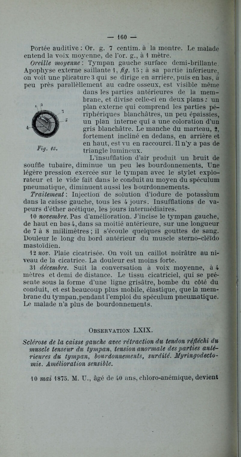 Portée auditive : Or. g. 7 centim. à la montre. Le malade entend la voix moyenne, de l’or, g., à 1 mètre. Oreille moyenne'. Tympan gauche surface demi-brillante Apophyse externe saillante 1, fig. 15 ; à sa partie inférieure, on voit une plicature 3 qui se dirige en arrière, puis en bas, à peu près parallèllement au cadre osseux, est visible même dans les parties antérieures de la mem- brane, et divise celle-ci en deux plans : un plan externe qui comprend les parties pé- riphériques blanchâtres, un peu épaissies, un plan interne qui a une coloration d’un gris blanchâtre. Le manche du marteau, 2, fortement incliné en dedans, en arrière et en haut, est vu en raccourci. Il n’y a pas de triangle lumineux. L’insufflation d’air produit un bruit de souffle tubaire, diminue un peu les bourdonnements. Une légère pression exercée sur le tympan avec le stylet explo- rateur et le vide fait dans le conduit au moyen du spéculum pneumatique, diminuent aussi les bourdonnements. Traitement : Injection de solution d’iodure de potassium dans la caisse gauche, tous les 4 jours. Insufflations de va- peurs d’éther acétique, les jours intermédiaires. 10 novembre. Pas d’amélioration. J’incise le tympan gauche, de haut en bas 4, dans sa moitié antérieure, sur une longueur de 7 à 8 millimètres ; il s’écoule quelques gouttes de sang. Douleur le long du bord antérieur du muscle sterno-cléïdo mastoïdien. 1 tnov. Plaie cicatrisée. On voit un caillot noirâtre au ni- veau de la cicatrice. La douleur est moins forte. 31 décembre. Suit la conversation à voix moyenne, à 4 mètres et demi de distance. Le tissu cicatriciel, qui se pré- sente sous la forme d’une ligne grisâtre, bombe du côté du conduit, et est beaucoup plus mobile, élastique, que la mem- brane du tympan,pendant l’emploi du spéculum pneumatique. Le malade n’a plus de bourdonnements. Fig. 4S. Observation LXIX. Sclérose de la caisse ga%iche avec rétraction du tendon réfléchi du muscle tenseur du tympan, tension anormale des parties anté- rieures du tympan, bourdonnements, surdité. Myringodecto- mit. Amélioration sensible. 10 mai 1875. M. U., âgé de 40 ans, chloro-anémique, devient