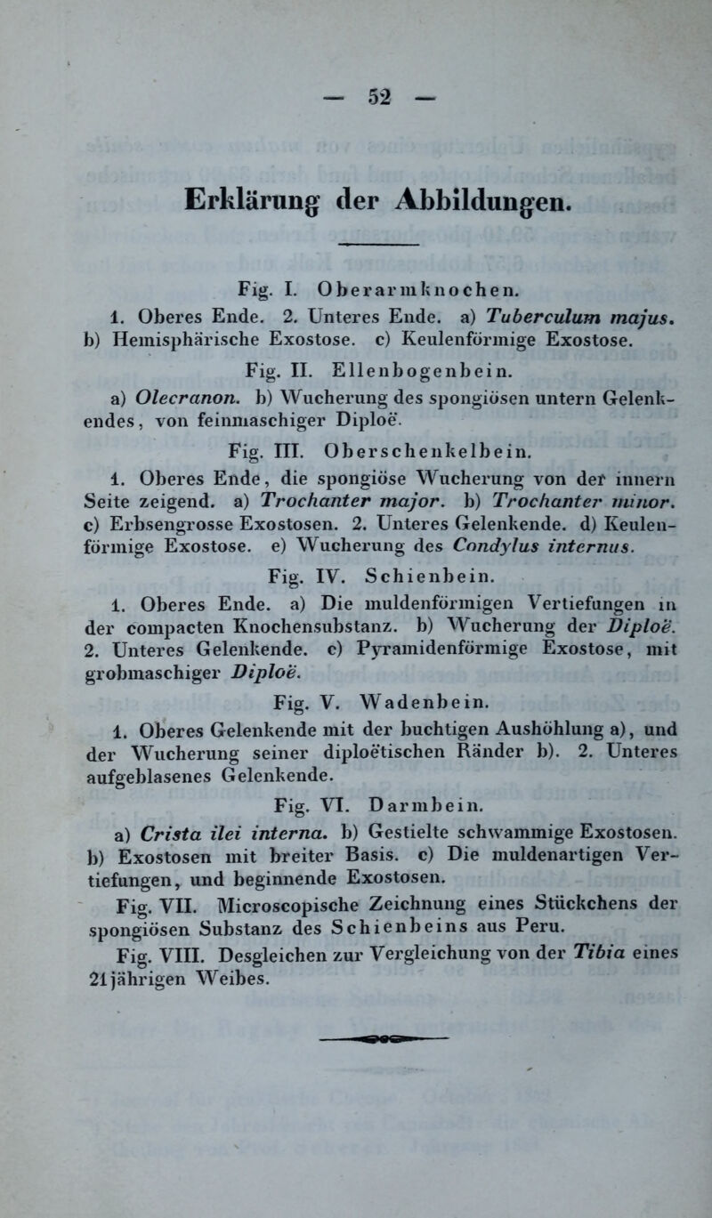 Erklärung der Abbildungen. Fig. I. Oberarniknochen. 1. Oberes Ende. 2. Unteres Ende, a) Tuberculum majus, b) Hemisphärische Exostose, c) Keulenförmige Exostose. Fig. II. Ellenbogenbein. a) Olecranon. b) Wucherung des spongiösen untern Gelenix- endes , von feinmaschiger Diploe. Fig. III. Oberschenkelbein. 1. Oberes Ende, die spongiöse Wucherung von der innern Seite zeigend, a) Trochanter major. b) Trochanter minor. c) Erbsengrosse Exostosen. 2. Unteres Gelenkende, d) Keulen- förmige Exostose, e) Wucherung des Condylus internus. Fig. IV. Schienbein. 1. Oberes Ende, a) Die muldenförmigen Vertiefungen in der compacten Knochensubstanz, b) Wucherung der Diploe. 2. Unteres Gelenkende, c) Pyramidenförmige Exostose, mit grobmaschiger Diploe. Fig. V. Wadenbein. 1. Oberes Gelenkende mit der buchtigen Aushöhlung a), und der Wucherung seiner diploetischen Ränder b). 2. Unteres aufgeblasenes Gelenkende. Fig. VI. Darmbein. a) Crista ilei interna, b) Gestielte schwammige Exostosen, b) Exostosen mit breiter Basis, c) Die muldenartigen Ver- tiefungen, und beginnende Exostosen. Fi°. VII. Microscopische Zeichnung eines Stückchens der spongiösen Substanz des Schienbeins aus Peru. Fig. VIII. Desgleichen zur Vergleichung von der Tibia eines 21jährigen Weibes.