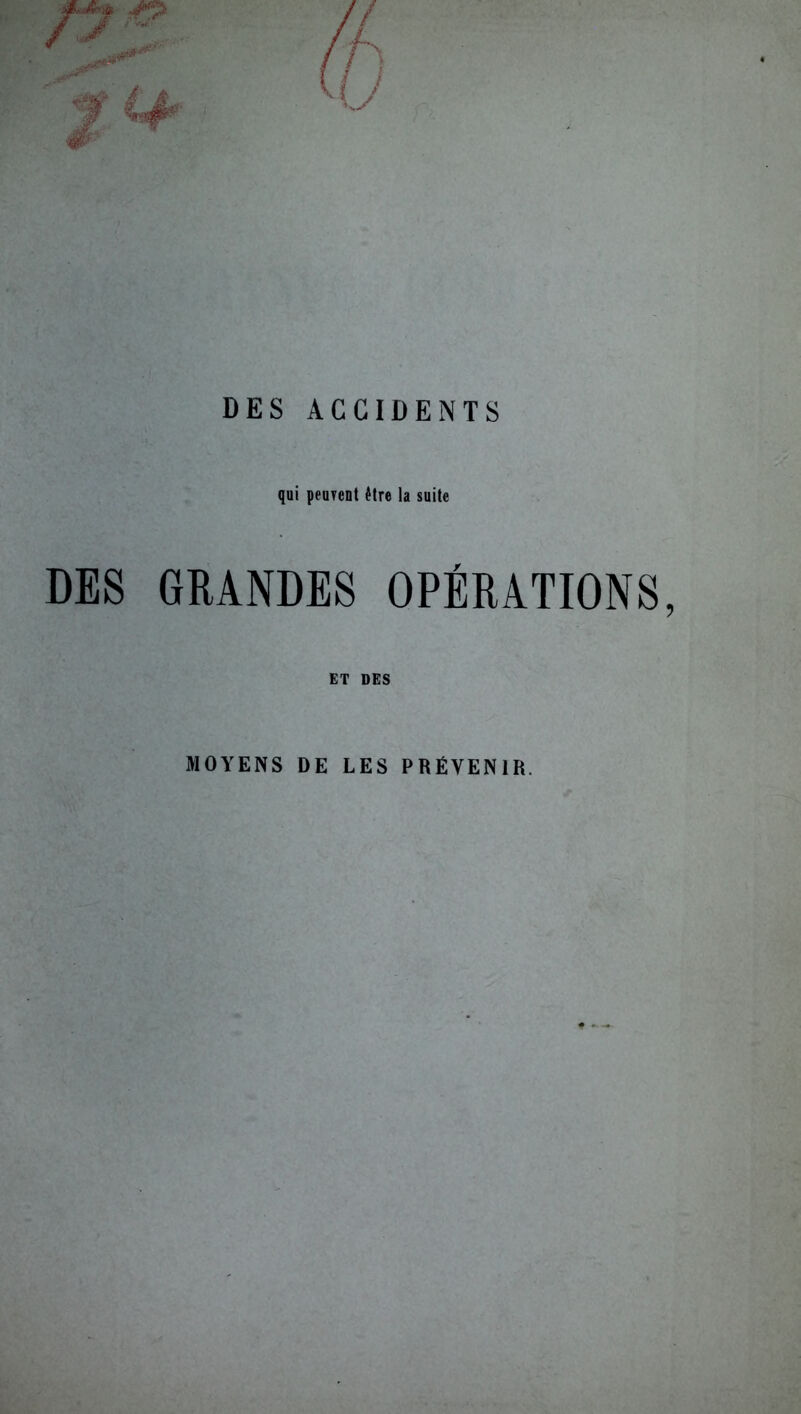 DES GRANDES OPÉRATIONS, ET DES MOYENS DE LES PRÉVENIR.