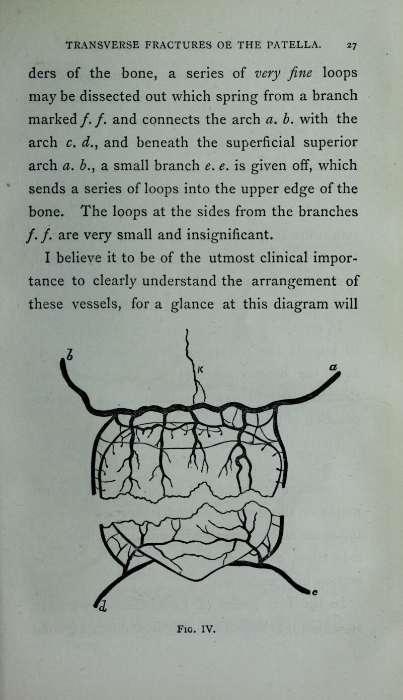ders of the bone, a series of very fine loops may be dissected out which spring from a branch marked /. /. and connects the arch a. b. with the arch c. d., and beneath the superficial superior arch a. b.y a small branch e. e. is given off, which sends a series of loops into the upper edge of the bone. The loops at the sides from the branches /. /. are very small and insignificant. I believe it to be of the utmost clinical impor- tance to clearly understand the arrangement of these vessels, for a glance at this diagram will Fig. IV.