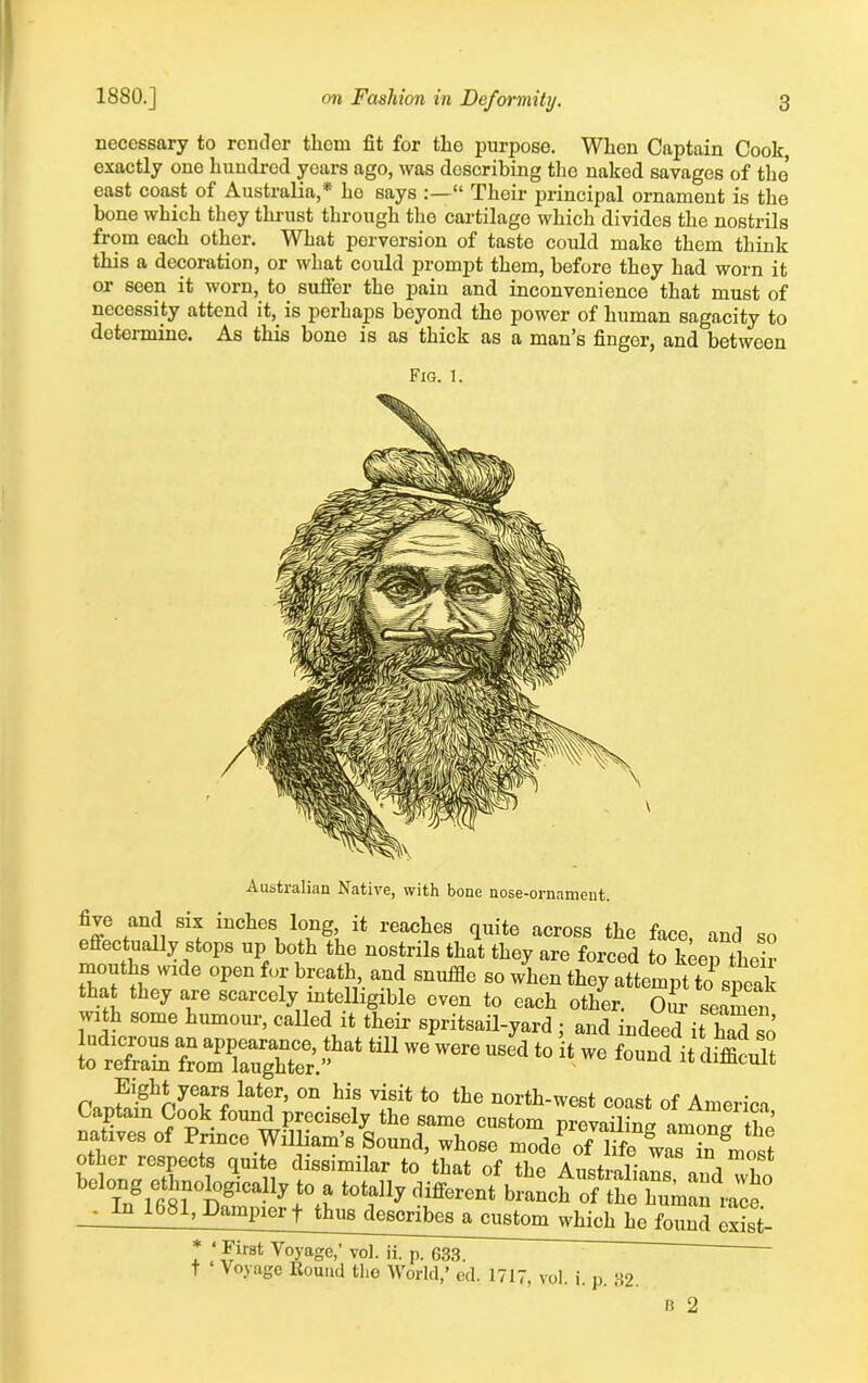 necessary to render them fit for the purpose. When Captain Cook, exactly one hundred years ago, was describing the naked savages of the cast coast of Australia,* ho says :—“ Their principal ornament is the bone which they thrust through the cartilage which divides the nostrils from each other. What perversion of taste could make them think this a decoration, or what could prompt them, before they had worn it or seen it worn, to suffer the pain and inconvenience that must of necessity attend it, is perhaps beyond tho power of human sagacity to determine. As this bone is as thick as a man’s finger, and between Fig. t. Australian Native, with bone nose-ornament. pS,tan?i Sif iu°heS, {t reaches <luite across the face, and so effectually stops up both the nostrils that they are forced to keen mouths wide open for breath and snuffle so when that they are scarcely intelligible oven to each other. Our seamen w. h some humour, called it their spritsail-yard ; and indeed itTd so to refrain fr3lanJZ’.^‘11,1 ''6 Were ‘° “ We &“d il difflralt Eight years later, on his visit to the north-west rnnat nf a Captain Cook found precisely the same custom prevailing among the natives of Prince William's Sound, whose mode* tf “if^“most other respects quite dissimilar to that of the Australians and who ' tg1681°TlSnC^l3’i0tn t0tflly d;ff0rcnt branch of 1,10 human race - In 3-68!, Dampierf thus describes a custom which he found cxist- * ‘First Voyage,’ vol. ii. p. G33. t ‘ Voyage Round the World,’ ed. 1717, vol. i.32.