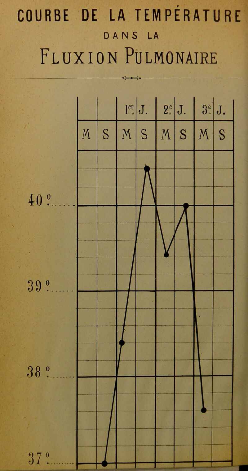 COURBE DE LA TEMPERATURE DANS LA Fluxion Pulmonaire