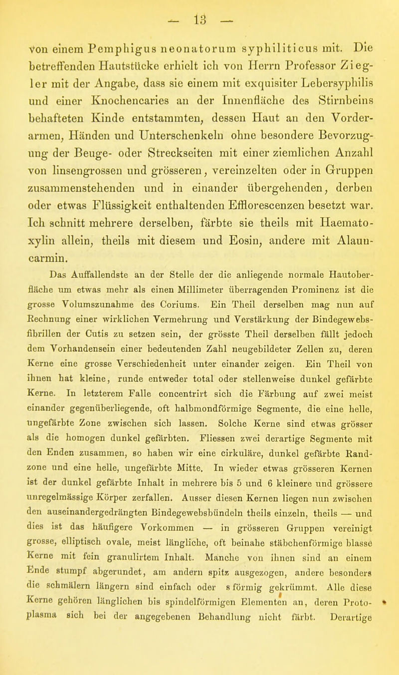 von einem Pemphigus neonatorum syphiliticus mit. Die betreffenden Hautstücke erhielt ich von Herrn Professor Zieg- ler mit der Angabe, dass sie einem mit exquisiter Lebersyphilis und einer Knochencaries an der Innenfläche des Stirnbeins behafteten Kinde entstammten, dessen Haut an den Vorder- armen, Händen und Unterschenkeln ohne besondere Bevorzug- ung der Beuge- oder Streckseiten mit einer ziemlichen Anzahl von linsengrossen und grösseren, vereinzelten oder in Gruppen zusammenstehenden und in einander übergehenden, derben oder etwas Flüssigkeit enthaltenden Efflorescenzen besetzt war. leb schnitt mehrere derselben, färbte sie theils mit Haemato- xylin allein, theils mit diesem und Eosin, andere mit Alauu- carmin. Das Auffallendste an der Stelle der die anliegende normale Hautober- fliiche um etwas mehr als einen Millimeter überragenden Prominenz ist die grosse Volumszunahme des Coriums. Ein Tbeil derselben mag nun auf Rechnung einer wirklichen Vermehrung und Verstärkung der Bindegewebs- fibrillen der Cutis zu setzen sein, der grösste Tbeil derselben fällt jedoch dem Vorhandensein einer bedeutenden Zahl neugehildeter Zellen zu, deren Kerne eine grosse Verschiedenheit unter einander zeigen. Ein Theil von ihnen hat kleine, runde entweder total oder stellenweise dunkel gefärbte Kerne. In letzterem Falle concentrirt sich die Färbung auf zwei meist einander gegenüberliegende, oft halbmondförmige Segmente, die eine helle, ungefärbte Zone zwischen sich lassen. Solche Kerne sind etwas grösser als die homogen dunkel gefärbten. Fliessen zwei derartige Segmente mit den Enden zusammen, so haben wir eine cirkuläre, dunkel gefärbte Rand- zone und eine helle, ungefärbte Mitte. In wieder etwas grösseren Kernen ist der dunkel gefärbte Inhalt in mehrere bis 5 und 6 kleinere und grössere unregelmässige Körper zerfallen. Ausser diesen Kernen liegen nun zwischen den auseinandergedrängten Bindegewehsbündeln theils einzeln, theils — und dies ist das häufigere Vorkommen — in grösseren Gruppen vereinigt grosse, elliptisch ovale, meist längliche, oft beinahe stäbchenförmige blasse Kerne mit fein granulirtem Inhalt. Manche von ihnen sind an einem Ende stumpf abgerundet, am andern spitz ausgezogen, andere besonders die schmälern längern sind einfach oder s förmig gekrümmt. Alle diese Kerne gehören länglichen bis spindelförmigen Elementen an, deren Proto- * plasma sich bei der angegebenen Behandlung nicht färbt. Derartige