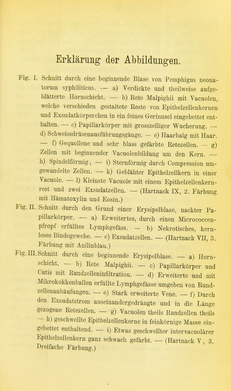 Erklärung der Abbildungen. Fig. I. Schnitt durch eine beginnende Blase von Pemphigus neona- torum syphiliticus. — a) Verdickte und theilweise aufge- blätterte Hornschicht. — b) Bete Malpighii mit Vacuolen, welche verschieden gestaltete Reste von Epithelzellenkernen und Exsudatkörperchen in ein feines Gerinnsel eingebettet ent- halten. — c) Papillarkörper mit grosszeiliger Wucherung. — d) Schweissdrüsenausführungsgänge. — e) Haarbalg mit Haar. f) Gequollene und sehr blass gefärbte Retezellen. — g) Zellen mit beginnender Vacuolenbildung um den Kern. — h) Spindelförmig, — i) Sternförmig durch Compression um- ge^andelte Zellen. — k) Geblähter Epithelzellkern in einer Vacuole. — 1) Kleinste Vacuole mit einem Epithelzellenkern- rest und zwei Exsudatzellen. — (Hartnack IX, 2. Färbung mit Hämatoxylin und Eosin.) I ig. n. Schnitt durch den Grund einer Erysipelblase, nackter Pa- pillarkörper. a) Erweitertes, durch einen Micrococcen- pfropf erfülltes Lymphgefäss. - b) Nekrotisches, kern- loses Bindegewebe. — c) Exsudatzellen. — (Hartnack VH, 3. Färbung mit Anilinblau.) I lg. IH. Schnitt durch eine beginnende Erysipelblase. — a) Horn- schicht. b) Rete Malpighii. — c) Papillarkörper und Cutis mit Rundzelleninfiltration. — d) Erweiterte und mit Mikrokokkenballen erfüllte Lymphgefässe umgeben von Rund- zellenanhäufungen. — e) Stark erweiterte Vene. — f) Durch den Exsudatstrom auseinandergedrängte und in die Länge gezogene Retezellen. — g) Vacuolen theils Rundzellen theila h) geschwellte Epithelzellenkerne in feinkörnige Masse ein- gebettet enthaltend. — i) Etwas geschwellter intervacuolärer Epithelzellenkern ganz schwach gefärbt. — (Hartnack V, 3. Dreifache Färbung.)