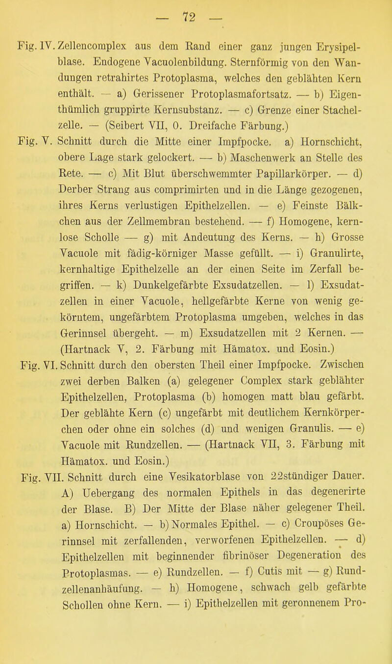 Fig. IV. Zellencomplex aus dem Rand einer ganz jungen Erysipel- blase. Endogene Vacuolenbildung. Sternförmig von den Wan- dungen retrahirtes Protoplasma, welches den geblähten Kern enthält. — a) Gerissener Protoplasmafortsatz. — b) Eigen- tümlich gruppirte Kernsubstanz. — c) Grenze einer Stachel- zelle. — (Seibert VII, 0. Dreifache Färbung.) Fig. V. Schnitt durch die Mitte einer Impfpocke, a) Hornschicht, obere Lage stark gelockert. — b) Maschenwerk an Stelle des Rete. — c) Mit Blut überschwemmter Papillarkörper. — d) Derber Strang aus comprimirten und in die Länge gezogenen, ihres Kerns verlustigen Epithelzellen. — e) Feinste Bälk- chen aus der Zellmembran bestehend. — f) Homogene, kern- lose Scholle — g) mit Andeutung des Kerns. — h) Grosse Vacuole mit fädig-körniger Masse gefüllt. — i) Granulirte, kernhaltige Epithelzelle an der einen Seite im Zerfall be- griffen. — k) Dunkelgefärbte Exsudatzellen. — 1) Exsudat- zellen in einer Vacuole, hellgefärbte Kerne von wenig ge- körntem, ungefärbtem Protoplasma umgeben, welches in das Gerinnsel übergeht. — m) Exsudatzellen mit 2 Kernen. — (Hartnack V, 2. Färbung mit Hämatox. und Eosin.) Fig. VI. Schnitt durch den obersten Theil einer Impfpocke. Zwischen zwei derben Balken (a) gelegener Complex stark geblähter Epithelzellen, Protoplasma (b) homogen matt blau gefärbt. Der geblähte Kern (c) ungefärbt mit deutlichem Kernkörper- chen oder ohne ein solches (d) und wenigen Granulis. — e) Vacuole mit Rundzellen. — (Hartnack VH, 3. Färbung mit Hämatox. und Eosin.) Fig. VII. Schnitt durch eine Vesikatorblase von 22stündiger Dauer. A) Uebergang des normalen Epithels in das degenerirte der Blase. B) Der Mitte der Blase näher gelegener Theil. a) Hornschicht. — b) Normales Epithel. — c) Croupöses Ge- rinnsel mit zerfallenden, verworfenen Epithelzellen. — d) Epithelzellen mit beginnender fibrinöser Degeneration des Protoplasmas. — e) Rundzellen. — f) Cutis mit — g) Rund- zellenanhäufung. — h) Homogene, schwach gelb gefärbte Schollen ohne Kern. — i) Epithelzellen mit geronnenem Pro-