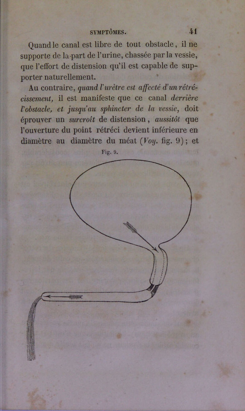 Quand le canal est libre de tout obstacle, il ne supporte de la part de l’urine, chassée par la vessie, que l’effort de distension qu’il est capable de sup- porter naturellement. Au contraire, quand lurètre est affecté d'un rétré- cissement, il est manifeste que ce canal derrière l'obstacle, et jusqu’au sphincter de la vessie, doit éprouver un surcroît de distension, aussitôt que l’ouverture du point rétréci devient inférieure en diamètre au diamètre du méat (Voy. fig. 9); et Fig. 9.