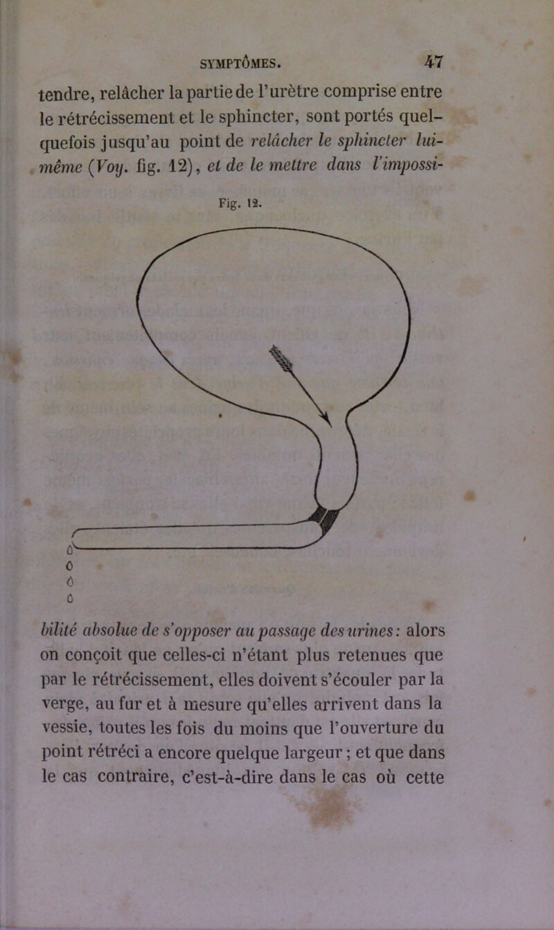 tendre, relâcher la partie de l’urètre comprise entre le rétrécissement et le sphincter, sont portés quel- quefois jusqu’au point de relâcher le sphincter lui- même (Voy. fig. 12), cl de le mettre dans l’impossi- Fig. 12. o hïlité absolue de s’opposer au passage des urines: alors on conçoit que celles-ci n’étant plus retenues que par le rétrécissement, elles doivent s’écouler par la verge, au fur et à mesure qu’elles arrivent dans la vessie, toutes les fois du moins que l’ouverture du point rétréci a encore quelque largeur ; et que dans le cas contraire, c’est-à-dire dans le cas où cette