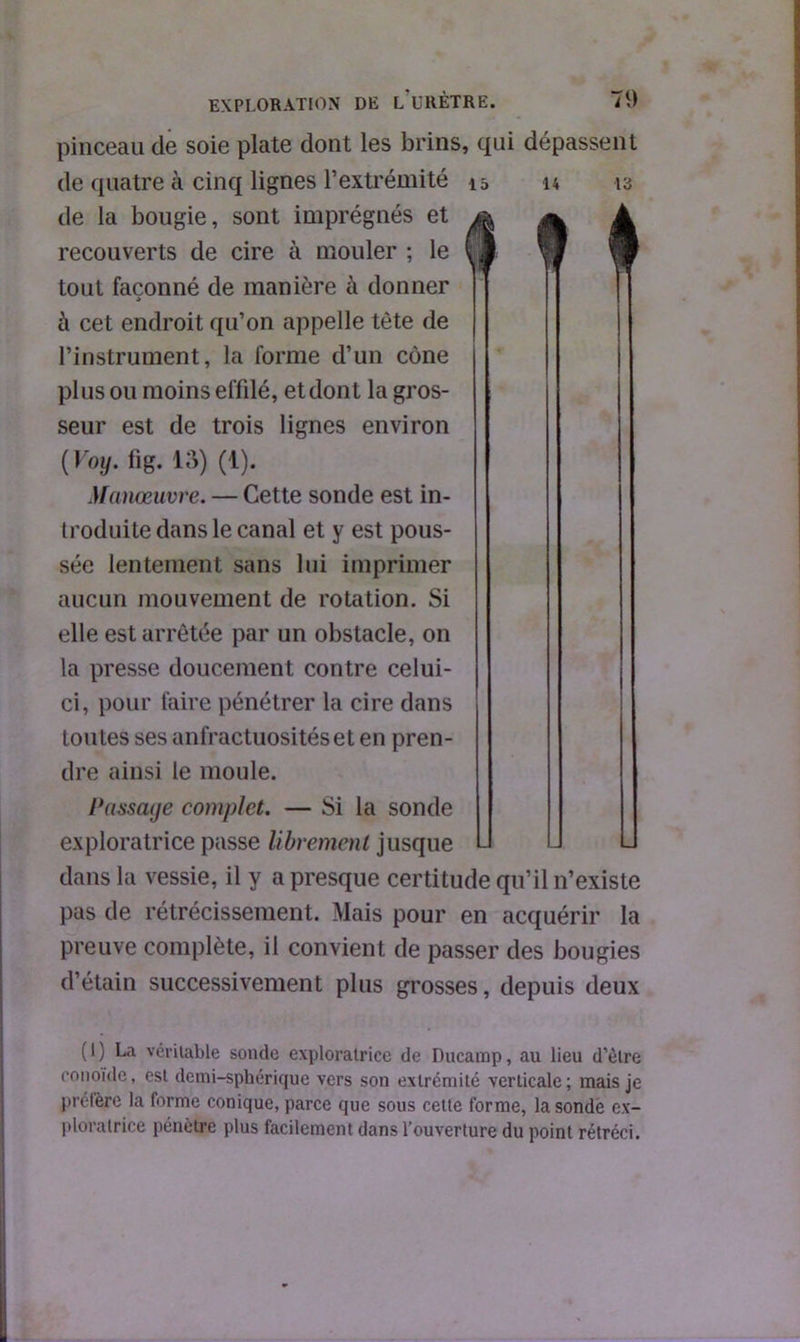 EXPLORATION DE L’URÈTRE. 7i) pinceau de soie plate dont les brins, qui dépassent de quatre à cinq lignes l’extrémité 1 s u 13 de la bougie, sont imprégnés et recouverts de cire à mouler ; le tout façonné de manière à donner » c\ cet endroit qu’on appelle tète de l’instrument, la forme d’un cône plus ou moins effilé, et dont la gros- seur est de trois lignes environ ( Voy. fig. 13) (1). Manœuvre. — Cette sonde est in- troduite dans le canal et y est pous- sée lentement sans lui imprimer aucun mouvement de rotation. Si elle est arrêtée par un obstacle, on la presse doucement contre celui- ci, pour faire pénétrer la cire dans toutes ses anfractuosités et en pren- dre ainsi le moule. Passage complet. — Si la sonde exploratrice passe librement jusque dans la vessie, il y a presque certitude qu’il n’existe pas de rétrécissement. Mais pour en acquérir la preuve complète, il convient de passer des bougies d’étain successivement plus grosses, depuis deux (1) La véritable sonde exploratrice de Ducamp, au lieu d’èlre conoïde, est demi-sphérique vers son extrémité verticale; mais je préfère la forme conique, parce que sous cette forme, la sonde ex- ploratrice pénètre plus facilement dans l’ouverture du point rétréci.