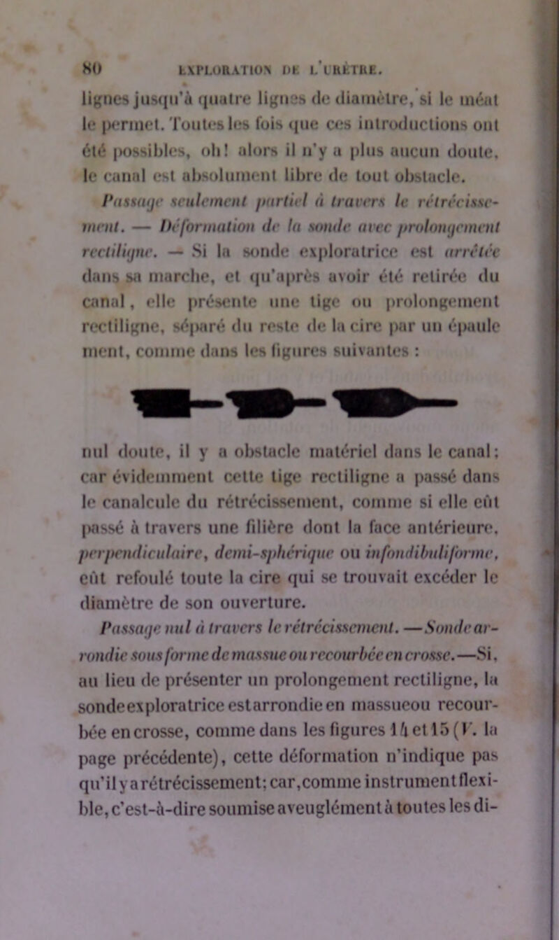 HO EXPLORATION DK L l'KfcTUE. lignes jusqu’à quatre ligues de diamètre, si le méat le permet. Toutes les fois que ces introductions ont été jKJssihles, oh! alors il n’y a plus aucun doute, le canal est absolument libre de tout obstacle. Passage seulement partiel ù travers le rétrécisse' ment. — Déformation de la sonde avec prolongement rectiligne. — Si la sonde exploratrice est arrêtée dans sii marche, et qu’après avoir été retirée du canal, elle présente une tige ou prolongement rectiligne, séparé du reste de la cire par un épaule ment, comme dans les figures suivantes : nul doute, il y a obstacle matériel dans le canal; car évidemment cette tige rectiligne a passé dans le canalcule du rétrécissement, comme si elle eût laissé à travers une filière dont la face antérieure, perjM'ndiculaire, demi-sphérique ou infondibuliforme, eût refoulé toute la cire qui se trouvait excéder le diamètre de son ouverture. Passage nul éi travers le rétrécissement. —Sonde ar- rondie sous forme de massue ou recourbée en crosse. —Si. au lieu de présenter un prolongement rectiligne, la sondeexploratriceestarrondieen massueou recour- bée en crosse, comme dans les figures 14etl5 (F. la page précédente), cette déformation n’indique pas qu’il y arétrécisscment; car,comme instrument flexi- ble, c’est-à-dire soumise aveuglément à toutes les di-