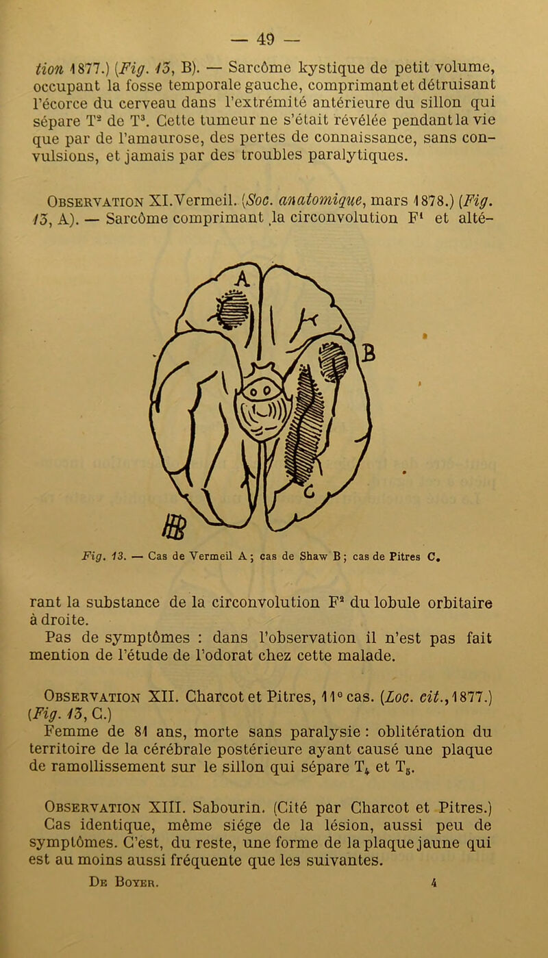 tion 1877.) {Fig. •/3, B). — Sarcôme kystique de petit volume, occupant la fosse temporale gauche, comprimant et détruisant l’écorce du cerveau dans l’extrémité antérieure du sillon qui sépare T- de Cette tumeur ne s’était révélée pendant la vie que par de l’amaurose, des pertes de connaissance, sans con- vulsions, et jamais par des troubles paralytiques. Observation Xl.Vermeil. {Soc. anatomique, mars 1878.) [Fig. /5, A). — Sarcôme comprimant ,1a circonvolution F‘ et alté- rant la substance de la circonvolution F® du lobule orbitaire à droite. Pas de symptômes : dans l’observation il n’est pas fait mention de l’étude de l’odorat chez cette malade. Observation XII. Charcot et Pitres, 11° cas. [Loc. ci^.,1877.) [Fig. •/3, C.) Femme de 81 ans, morte sans paralysie : oblitération du territoire de la cérébrale postérieure ayant causé une plaque de ramollissement sur le sillon qui sépare T4 et Tg. Observation XIII. Sabourin. (Cité par Charcot et Pitres.) Cas identique, même siège de la lésion, aussi peu de symptômes. C’est, du reste, une forme de la plaque jaune qui est au moins aussi fréquente que les suivantes. De Boyer. 4