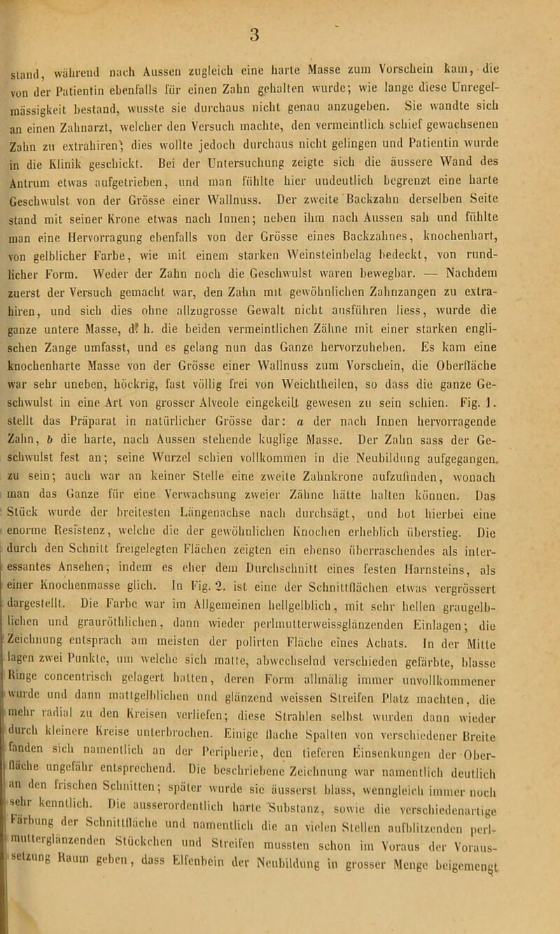 sliiml, währeml nucli Aussen zugleich eine harte Masse zmn Vorschein tain, die von der Patientin ebenfalls für einen Zahn gehalten wurde; wie lange diese Unregel- mässigkeit bestand, wusste sie durchaus nicht genau anzugehen. Sie wandte sich an einen Zahnarzt, welcher den Versuch machte, den vermeintlich schief gewachsenen Zahn zu extrahiren' dies wollte jedoch durchaus nicht gelingen und Patientin wurde in die Klinik geschickt. Bei der Untersuchung zeigte sich die äussere Wand des Antrum etwas aufgetriehen, und man fühlte hier undeutlich begrenzt eine harte Geschwulst von der Grösse einer Wallnuss. Der zweite Backzahn derselben Seite stand mit seiner Krone etwas nach Innen; neben ihm nach Aussen sah und fühlte man eine Hervorragung ebenfalls von der Grösse eines Backzahnes, knochenhart, von gelblicher Farbe, wie mit einem starken Weinsteinbelag bedeckt, von rund- licher Form. Weder der Zahn noch die Geschwulst waren bewegbar. — Nachdem zuerst der Versuch gemacht war, den Zahn mit gewöhnlichen Zahnzangen zu extra- hiren, und sich dies ohne allzugrosse Gewalt nicht ausführen liess, wurde die ganze untere Masse, d? h. die beiden vermeintlichen Zähne mit einer starken engli- schen Zange umfasst, und es gelang nun das Ganze hervorzuheben. Es kam eine knochenharte Masse von der Grösse einer Wallnuss zum Vorschein, die Oberfläche war sehr uneben, höckrig, fast völlig frei von Weichtheilcn, so dass diu ganze Ge- schwulst in eine Art von grosser Alveole cingekeiU gewesen zu sein schien. Fig. 1. stellt das Präparat in natürlicher Grösse dar: a der nach Innen hervorragende Zahn, b die harte, nach Aussen stehende kuglige Masse. Der Zahn sass der Ge- schwulst fest an; seine Wurzel schien vollkommen in die Neubildung aufgegangen. zu sein; auch war an keiner Stelle eine zweite Zahnkrone aufzulinden, wonach man das Ganze für eine Verwachsung zweier Zähne hätte halten können. Das Stück wurde der breitesten Längenachse nach durchsägt, und bot hierbei eine enorme Resistenz, welche die der gewöhnlichen Knochen erheblich überstieg. Die durch den Schnitt freigelegten Flächen zeigten ein ebenso überraschendes als inter- essantes Ansehen; indem es eher dem Durchschnitt eines festen Harnsteins, als einer Knochenmasse glich, ln Fig. 2. ist eine der Schnittflächen etwas vergrössert dargestellt. Die Farbe war im Allgemeinen hellgelblich, mit sehr hellen graugelb- lichen und grauröthlichcn, dann wieder perlmuttcrweissglanzenden Einlagen; die Zeichnung entsprach am meisten der polirten Fläche eines Achats, ln der Milte lagen zwei Punkte, um welche sich malte, abwechselnd verschieden gefärbte, blasse Hinge concentrisch gelagert hatten, deren Form allmälig immer unvullkoinmener wurde und dann matlgelblicheu und glänzend weissen Streifen Platz machten, die mehr radial zu den Kreisen verliefen; diese Strahlen selbst wurden dann wieder durch kleinere Kreise unterbrochen. Einige flache Spalten von verschiedener Breite fanden sich namentlich an der I'eriphcrie, den tieferen Einsenkungen der Oher- fläche ungefähr entsprechend. Die beschriebene Zeichnung war namentlich deutlich an den frischen Schnitten; später wurde sie äusserst blass, wenngleich immernoch sehr kenntlich. Die ausserordentlich harte Substanz, sowie die verschiedenartige larbung der Schnittfläche und namentlich die an vielen Stellen aufblitzenden perl- mutterglänzenden Stückchen und Streifen mussten schon im Voraus der Voraus- setzung Kaum gehen, dass Elfenbein der Neubildung in grosser Menge beigemenqt