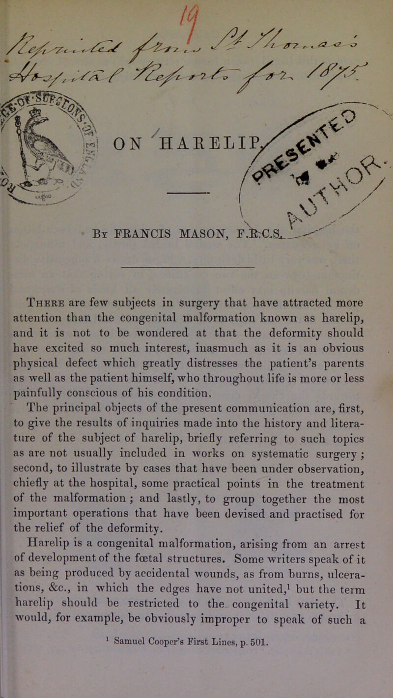 /' t * r tC . 'SsC f \ V Bx FRANCIS MASON, F.E;C.S,. _ Ws° / ^ V There are few subjects in surgery that have attracted more attention than the congenital malformation known as harelip, and it is not to be wondered at that the deformity should have excited so much interest, inasmuch as it is an obvious physical defect which greatly distresses the patient’s parents as well as the patient himself, who throughout life is more or less painfully conscious of his condition. The principal objects of the present communication are, first, to give the results of inquiries made into the history and litera- ture of the subject of harelip, briefly referring to such topics as are not usually included in works on systematic surgery ; second, to illustrate by cases that have been under observation, chiefly at the hospital, some practical points in the treatment of the malformation ; and lastly, to group together the most important operations that have been devised and practised for the relief of the deformity. Harelip is a congenital malformation, arising from an arrest of development of the foetal structures. Some writers speak of it as being produced by accidental wounds, as from burns, ulcera- tions, &c., in which the edges have not united,1 but the term harelip should be restricted to the congenital variety. It would, for example, be obviously improper to speak of such a