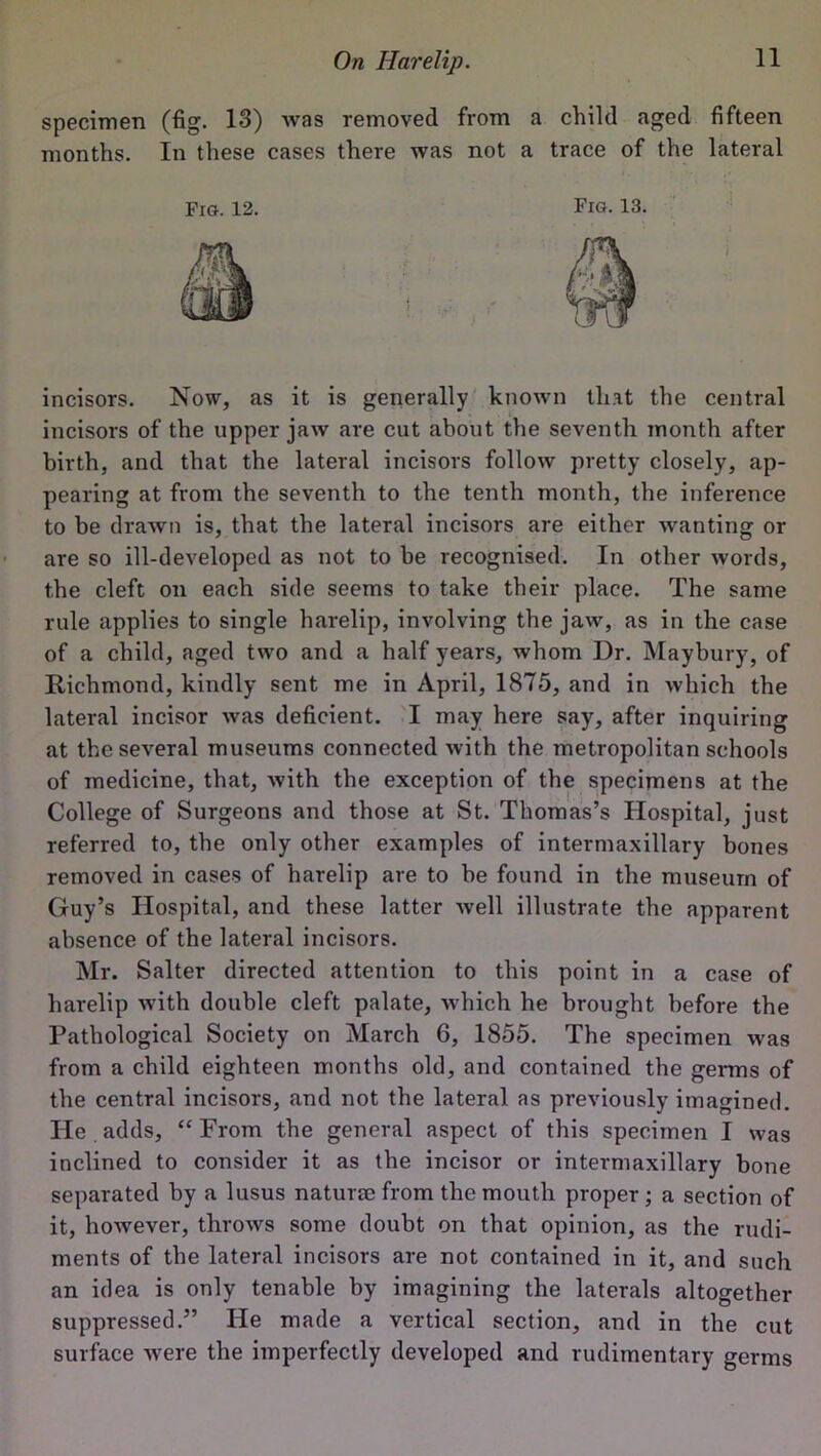 specimen (fig. 13) was removed from a child aged fifteen months. In these cases there was not a trace of the lateral Fro. 12. Fro. 13. incisors. Now, as it is generally known that the central incisors of the upper jaw are cut about the seventh month after birth, and that the lateral incisors follow pretty closely, ap- pearing at from the seventh to the tenth month, the inference to be drawn is, that the lateral incisors are either wanting or are so ill-developed as not to be recognised. In other words, the cleft on each side seems to take their place. The same rule applies to single harelip, involving the jaw, as in the case of a child, aged two and a half years, whom Dr. Maybury, of Richmond, kindly sent me in April, 1875, and in which the lateral incisor was deficient. I may here say, after inquiring at the several museums connected with the metropolitan schools of medicine, that, with the exception of the specimens at the College of Surgeons and those at St. Thomas’s Hospital, just referred to, the only other examples of intermaxillary bones removed in cases of harelip are to be found in the museum of Guy’s Hospital, and these latter well illustrate the apparent absence of the lateral incisors. Mr. Salter directed attention to this point in a case of harelip with double cleft palate, which he brought before the Pathological Society on March 6, 1855. The specimen was from a child eighteen months old, and contained the germs of the central incisors, and not the lateral as previously imagined. He adds, “ From the general aspect of this specimen I was inclined to consider it as the incisor or intermaxillary bone separated by a lusus naturae from the mouth proper; a section of it, however, throws some doubt on that opinion, as the rudi- ments of the lateral incisors are not contained in it, and such an idea is only tenable by imagining the laterals altogether suppressed.” He made a vertical section, and in the cut surface were the imperfectly developed and rudimentary germs