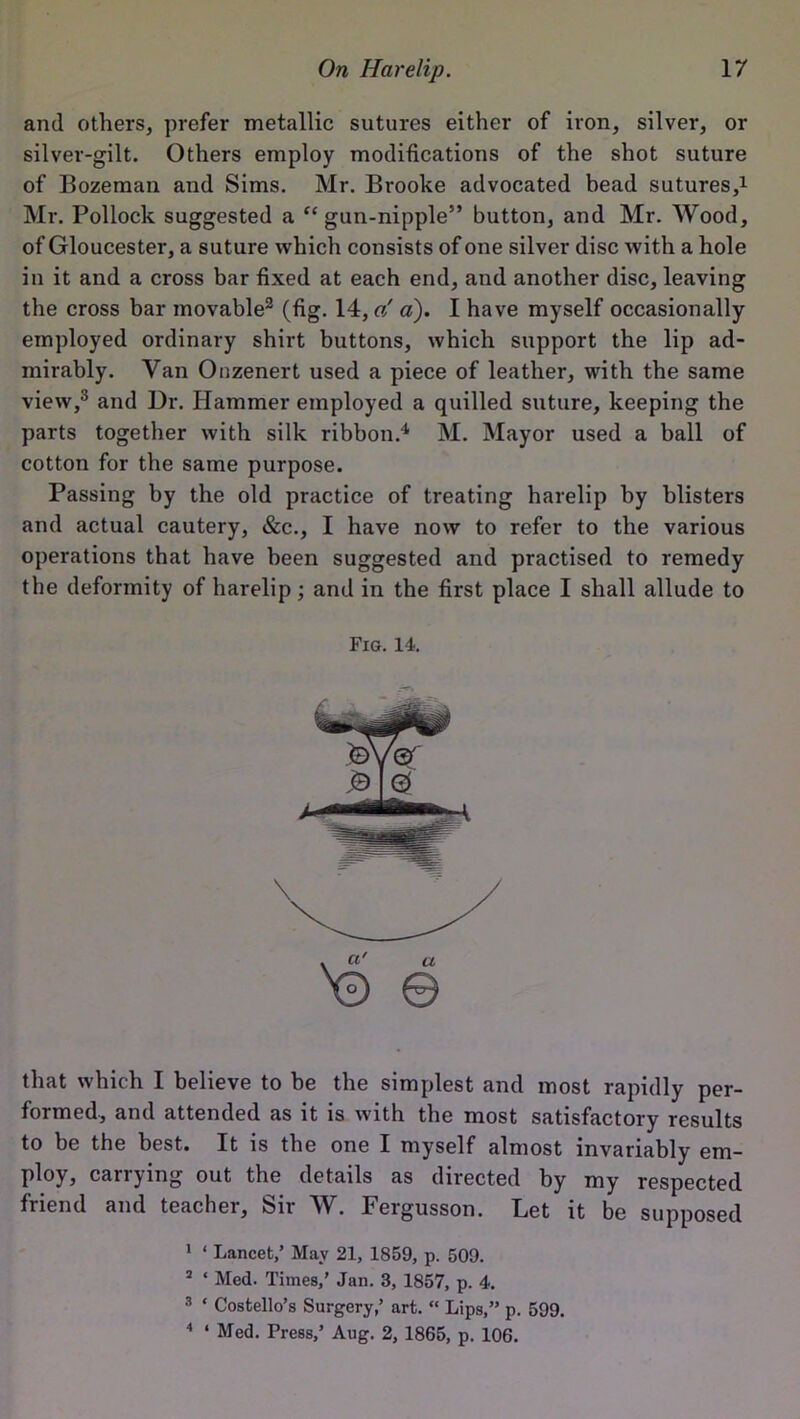 and others, prefer metallic sutures either of iron, silver, or silver-gilt. Others employ modifications of the shot suture of Bozeman and Sims. Mr. Brooke advocated bead sutures,1 Mr. Pollock suggested a “gun-nipple” button, and Mr. Wood, of Gloucester, a suture which consists of one silver disc with a hole in it and a cross bar fixed at each end, and another disc, leaving the cross bar movable2 (fig. 14,o! a). I have myself occasionally employed ordinary shirt buttons, which support the lip ad- mirably. Van Onzenert used a piece of leather, with the same view,3 and Dr. Hammer employed a quilled suture, keeping the parts together with silk ribbon.4 M. Mayor used a ball of cotton for the same purpose. Passing by the old practice of treating harelip by blisters and actual cautery, &c., I have now to refer to the various operations that have been suggested and practised to remedy the deformity of harelip; and in the first place I shall allude to Fig. 14. that which I believe to be the simplest and most rapidly per- formed, and attended as it is with the most satisfactory results to be the best. It is the one I myself almost invariably em- ploy, carrying out the details as directed by my respected friend and teacher, fen W. Fergusson. Bet it be supposed 1 ‘ Lancet,’ May 21, 1859, p. 509. 2 * Med. Times,’ Jan. 3, 1857, p. 4. 3 ‘ Costello’s Surgery,’ art. “ Lips,” p. 599. 4 ‘ Med. Press,’ Aug. 2, 1865, p. 106.