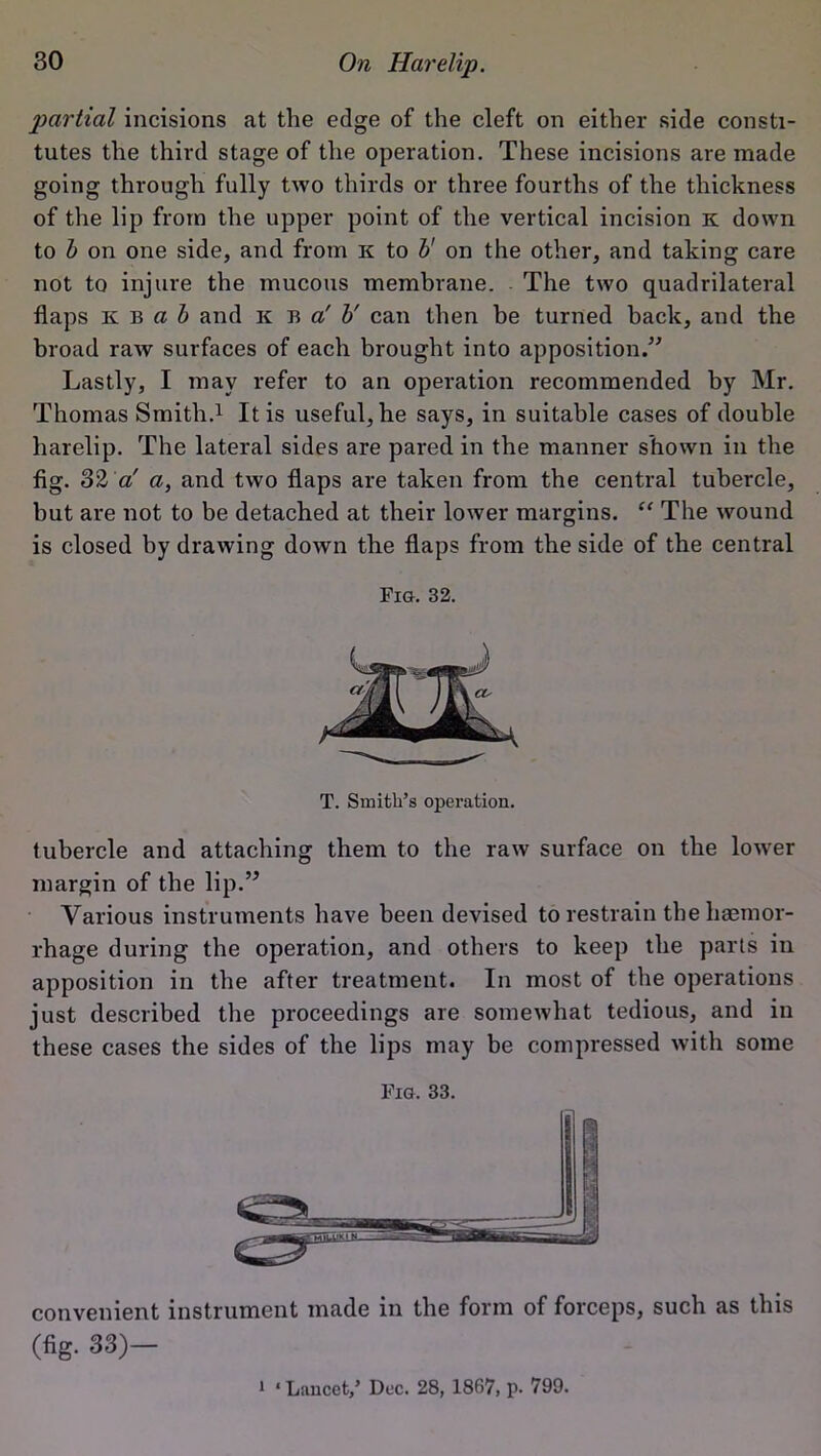 partial incisions at the edge of the cleft on either side consti- tutes the third stage of the operation. These incisions are made going through fully two thirds or three fourths of the thickness of the lip from the upper point of the vertical incision k down to b on one side, and from k to b' on the other, and taking care not to injure the mucous membrane. The two quadrilateral flaps kb a b and k b a' b' can then be turned hack, and the broad raw surfaces of each brought into apposition.” Lastly, I may refer to an operation recommended by Mr. Thomas Smith.1 It is useful, he says, in suitable cases of double harelip. The lateral sides are pared in the manner shown in the fig. 32 a a, and two flaps are taken from the central tubercle, but are not to be detached at their lower margins. “ The wound is closed by drawing down the flaps from the side of the central Fig. 32. T. Smith’s operation. tubercle and attaching them to the raw surface on the lower margin of the lip.” Various instruments have been devised to restrain the haemor- rhage during the operation, and others to keep the parts in apposition in the after treatment. In most of the operations just described the proceedings are somewhat tedious, and in these cases the sides of the lips may be compressed with some Fig. 33. convenient instrument made in the form of forceps, such as this (fig. 33)- ' ‘ Lancet,’ Dec. 28, 1867, p. 799.