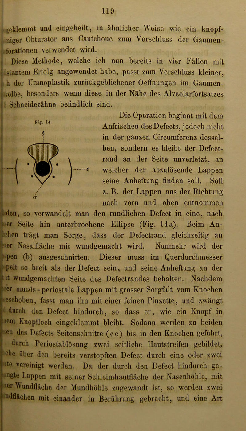 reklemmt und eingeheilt, in ähnlicher Weise wie ein knopf- niger Obturator aus Cautchouc zum Vorschluss der Gaumen- lorationen verwendet wird. Diese Methode, welche ich nun bereits in vier Fällen mit stantem Erfolg angewendet habe, passt zum Verschluss kleiner, h der Uranoplastik zurückgebliebener Oeffnungen im Gaumen- ;ölbe, besonders wenn diese in der Nähe des Alveolarfortsatzes Schneidezähne befindlich sind. Die Operation beginnt mit dem Anfrischen des Defects, jedoch nicht in der ganzen Circumferenz dessel- ben, sondern es bleibt der Defect- rand an der Seite unverletzt, an welcher der abzulösende Lappen seine Anheftung finden soll. Soll z. B. der Lappen aus der Richtung nach vorn und oben entnommen .den, so verwandelt man den rundlichen Defect in eine, nach .er Seite hin unterbrochene Ellipse (Fig. 14 a). Beim An- 3hen trägt man Sorge, dass der Defectrand gleichzeitig an per Nasalfläche mit wundgemacht wird. Nunmehr wird der pen (b) ausgeschnitten. Dieser muss im Querdurchmesser pelt so breit als der Defect sein, und seine Anheftung an der it wundgemachten Seite des Defectrandes behalten. Nachdem ; >er mucös - periostale Lappen mit grosser Sorgfalt vom Knochen eschoben, fasst man ihn mit einer feinen Pinzette, und zwängt durch den Defect hindurch, so dass er, wie ein Knopf in ‘ icrn Knopfloch eingeklemmt bleibt. Sodann werden zu beiden *i.en des Defects Seitenschnitte (cc) bis in den Knochen geführt, durch Periostablösung zwei seitliche Hautstreifen gebildet, r C*IC über den bereits verstopften Defect durch eine oder zwei !lto vereinigt werden. Da der durch den Defect hindurch ge- ngte Lappen mit seiner Schleimhautfläche der Nasenhöhle, mit mer Wundfläche der Mundhöhle zugewandt ist, so werden zwei ndflächen mit einander in Berührung gebracht, und eine Art