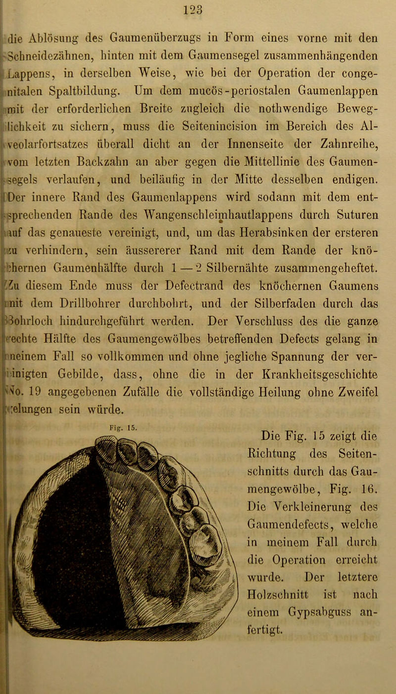 die Ablösung des Gaumenüberzugs in Form eines vorne mit den Schneidezähnen, hinten mit dem Gaumensegel zusammenhängenden t Lappens, in derselben Weise, wie bei der Operation der conge- nitalen Spaltbildung. Um dem mucös-periostalen Gaumenlappen mit der erforderlichen Breite zugleich die nothwendige Beweg- lichkeit zu sichern, muss die Seitenincision im Bereich des Al- j veolarfortsatzes überall dicht an der Innenseite der Zahnreihe, vom letzten Backzahn an aber gegen die Mittellinie des Gaumen- segels verlaufen, und beiläufig in der Mitte desselben endigen. Der innere Rand des Gaumenlappens wird sodann mit dem ent- sprechenden Rande des Wangenschleimhautlappens durch Suturen luf das genaueste vereinigt, und, um das Herabsinken der ersteren iu verhindern, sein äussererer Rand mit dem Rande der knö- chernen Gaumenhälfte durch 1—2 Silbernähte zusammengeheftet. Zu diesem Ende muss der Defectrand des knöchernen Gaumens nit dem Drillbohrer durchbohrt, und der Silberfaden durch das Bohrloch hindurchgeführt werden. Der Verschluss des die ganze ■echte Hälfte des Gaumengewölbes betreffenden Defects gelang in neinem Fall so vollkommen und ohne jegliche Spannung der ver- einigten Gebilde, dass, ohne die in der Krankheitsgeschichte Wo. 19 angegebenen Zufälle die vollständige Heilung ohne Zweifel gelungen sein würde. Fig. 15. Die Fig. 15 zeigt die Richtung des Seiten- schnitts durch das Gau- mengewölbe, Fig. 16. Die Verkleinerung dos Gaumendefects, welche in meinem Fall durch die Operation erreicht wurde. Der letztere Holzschnitt ist nach einem Gypsabguss an- fertigt.